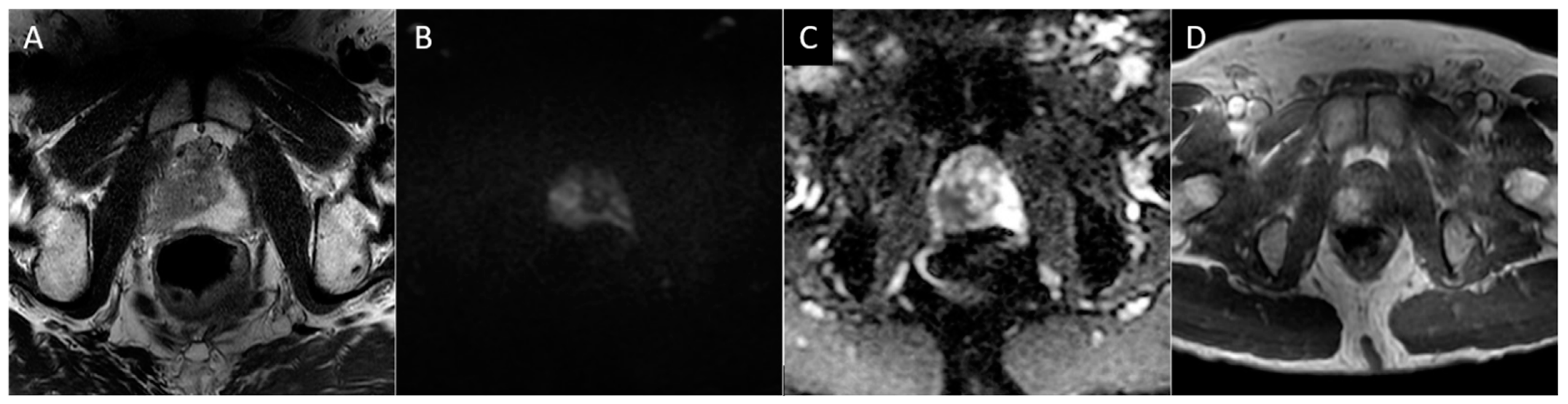 Diagnostics 13 01860 g002 Diagnostics 13 01860 g002