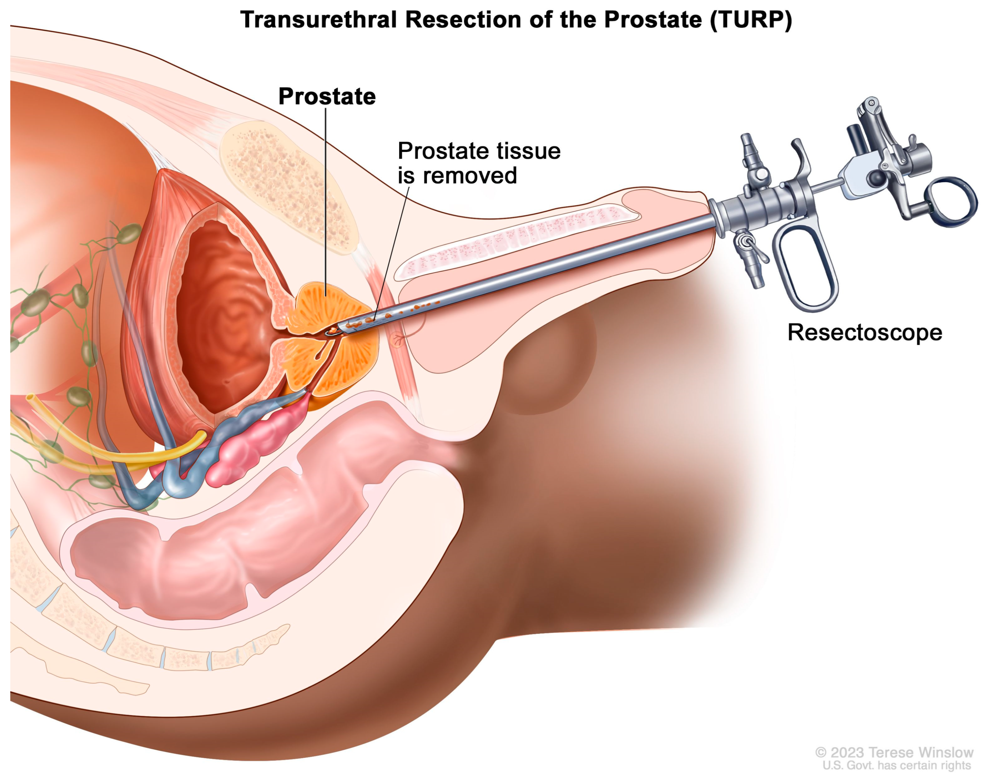 Diagnostics 13 01860 g004 Diagnostics 13 01860 g004