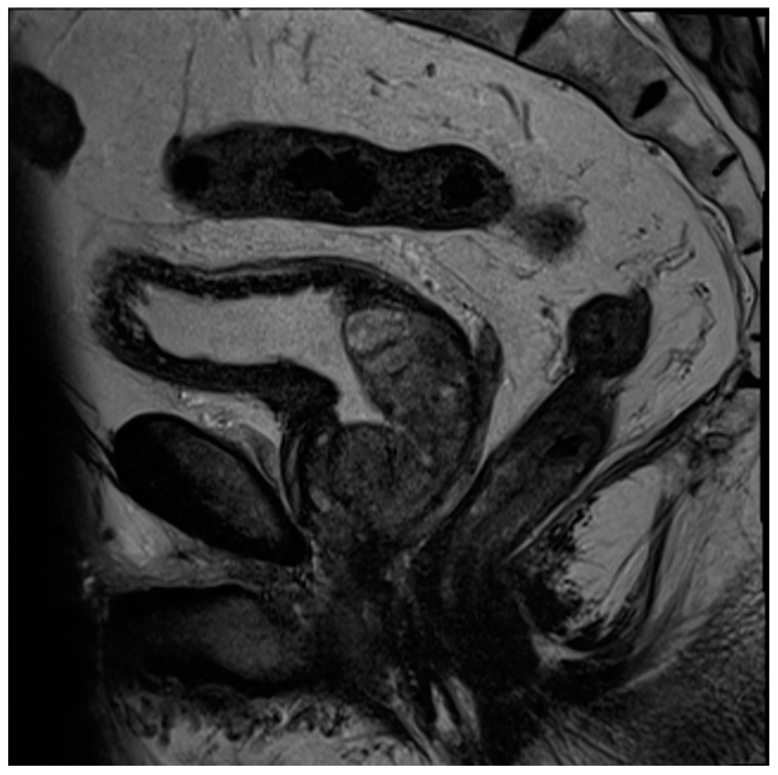 Diagnostics 13 01860 g005 Diagnostics 13 01860 g005