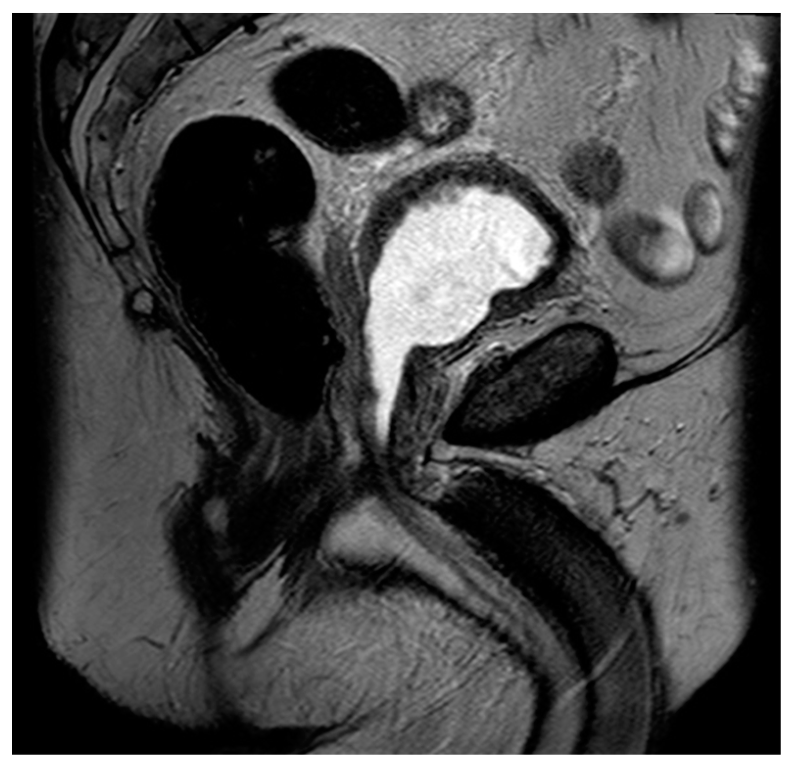 Diagnostics 13 01860 g006 Diagnostics 13 01860 g006