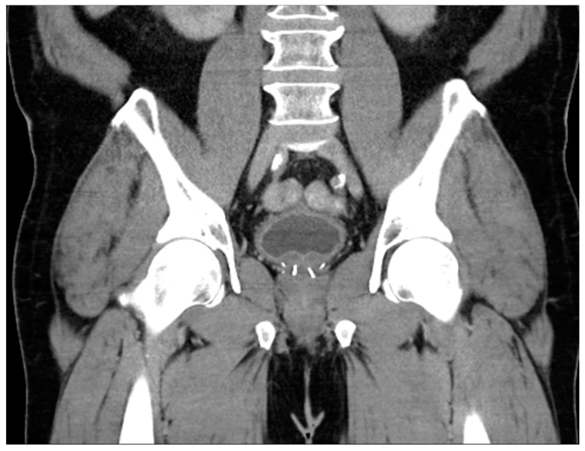 Diagnostics 13 01860 g007 Diagnostics 13 01860 g007
