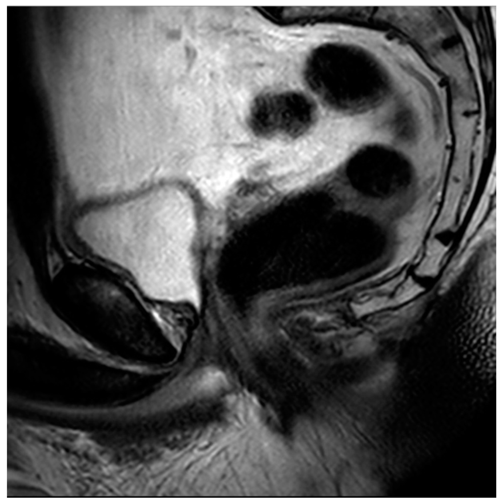 Diagnostics 13 01860 g008 Diagnostics 13 01860 g008