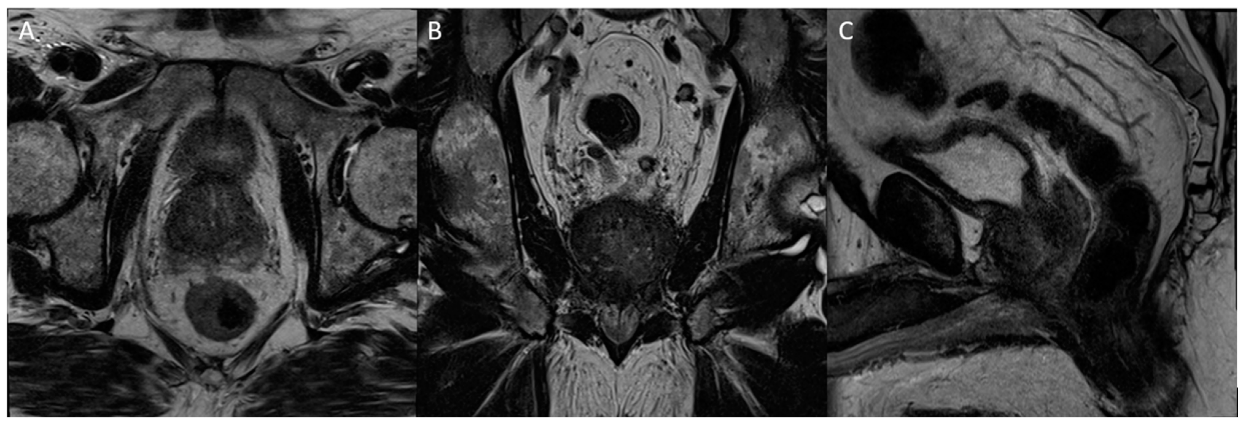 Diagnostics 13 01860 g009 Diagnostics 13 01860 g009