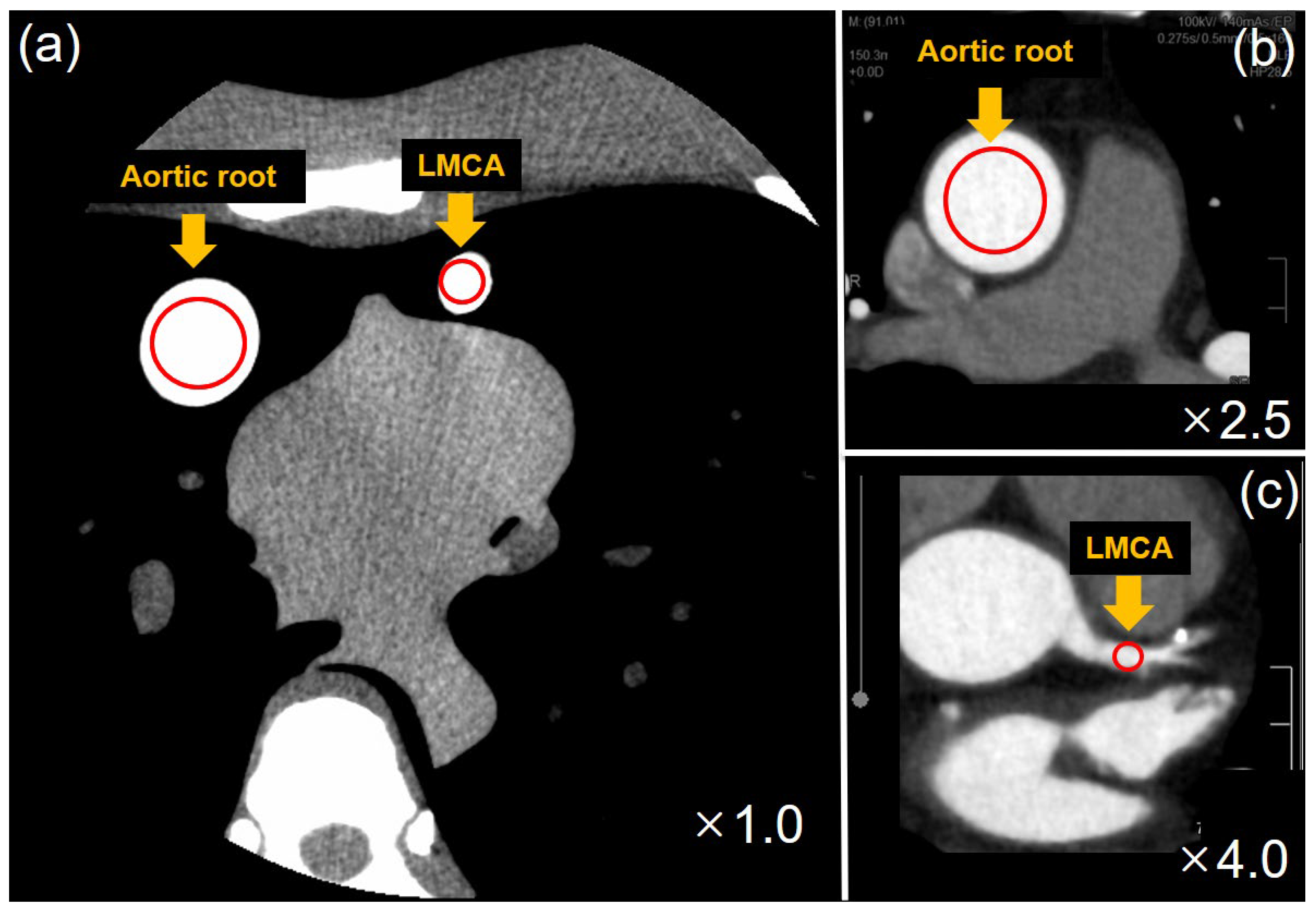 Diagnostics 13 01862 g003