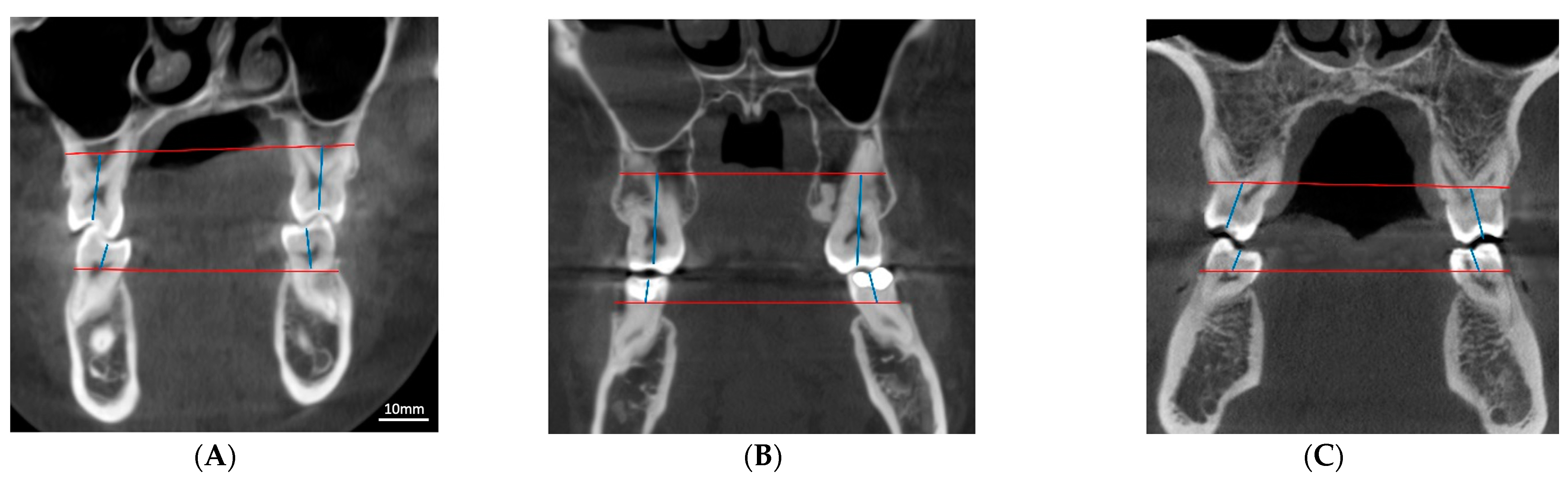 Diagnostics 13 01875 g003 Diagnostics 13 01875 g003