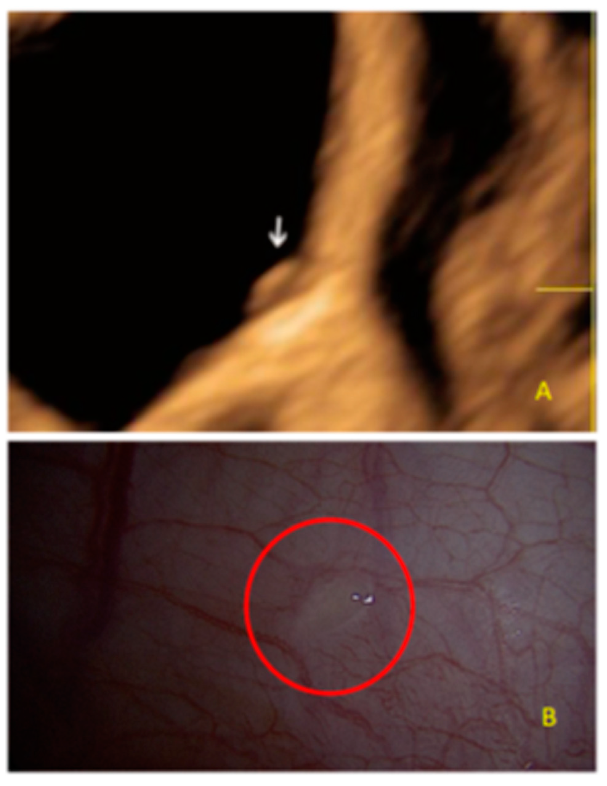 Diagnostics 13 01876 g002 Diagnostics 13 01876 g002