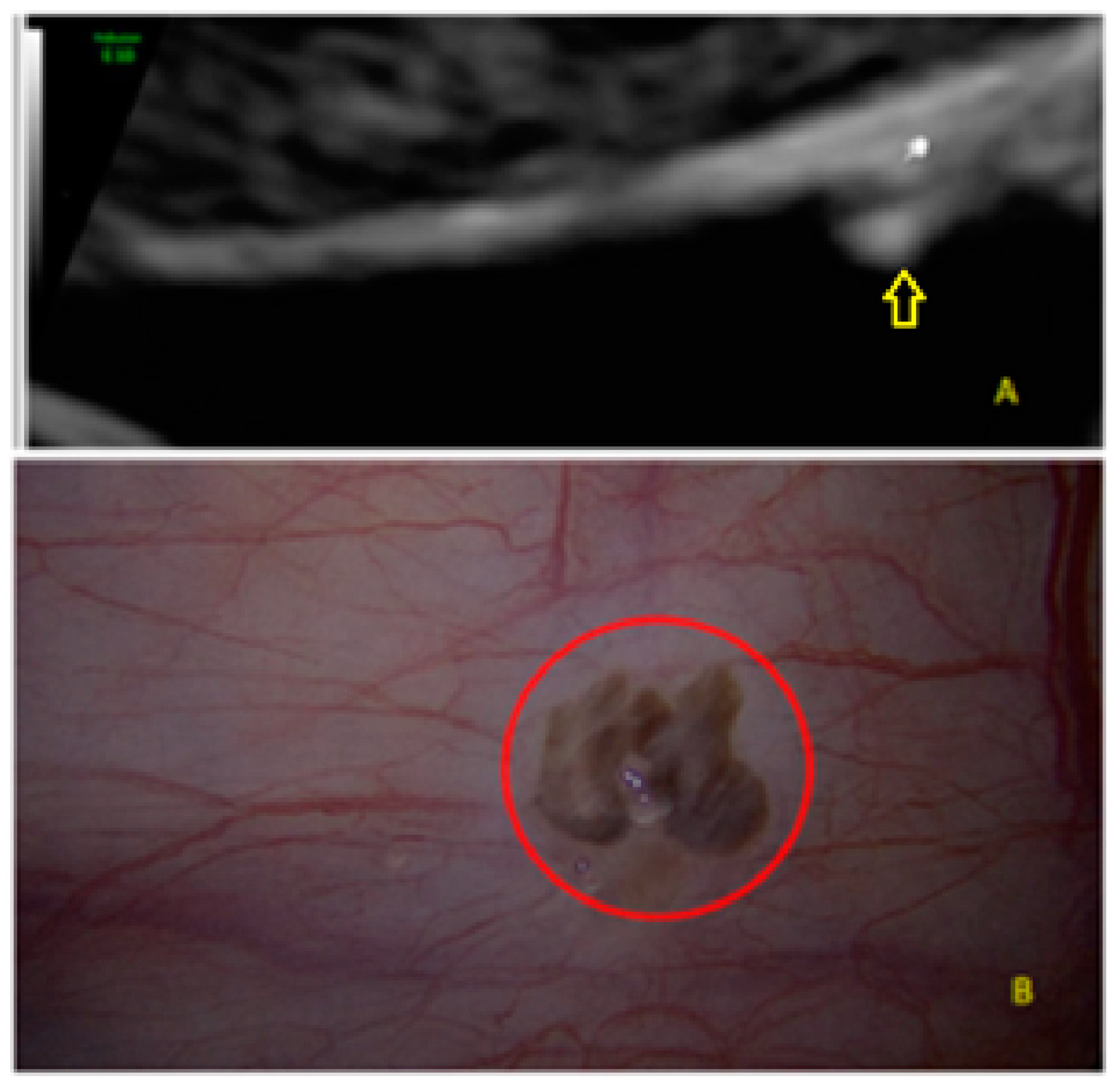 Diagnostics 13 01876 g003 Diagnostics 13 01876 g003