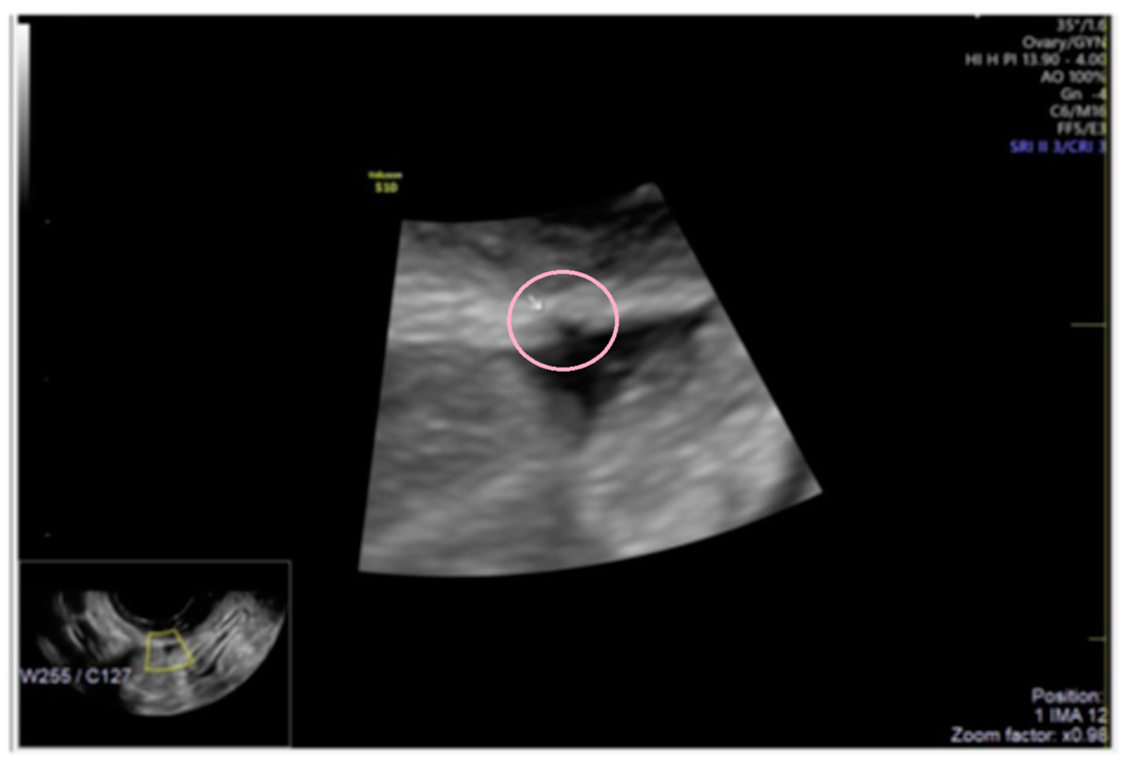 Diagnostics 13 01876 g006 Diagnostics 13 01876 g006