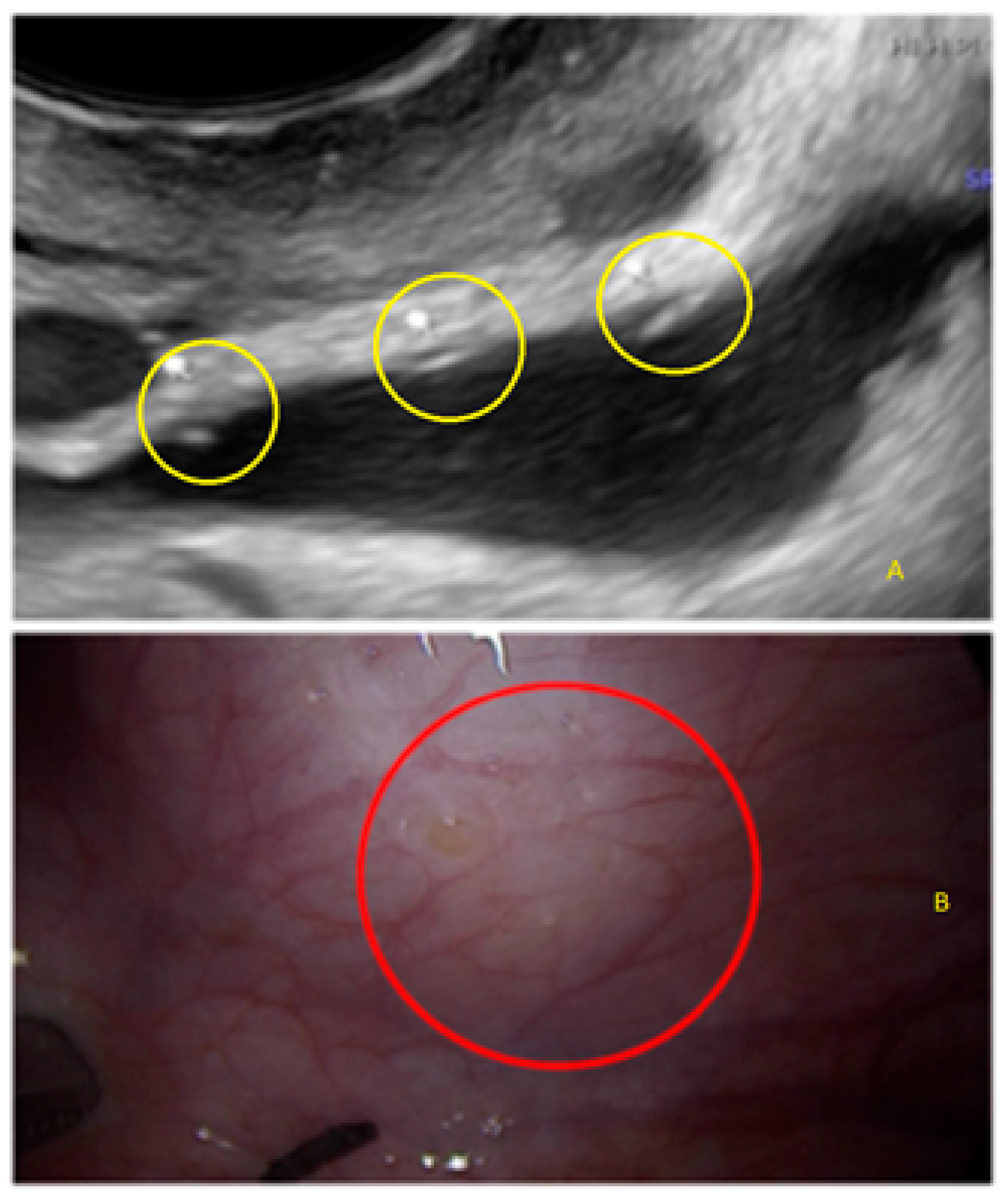Diagnostics 13 01876 g007 Diagnostics 13 01876 g007
