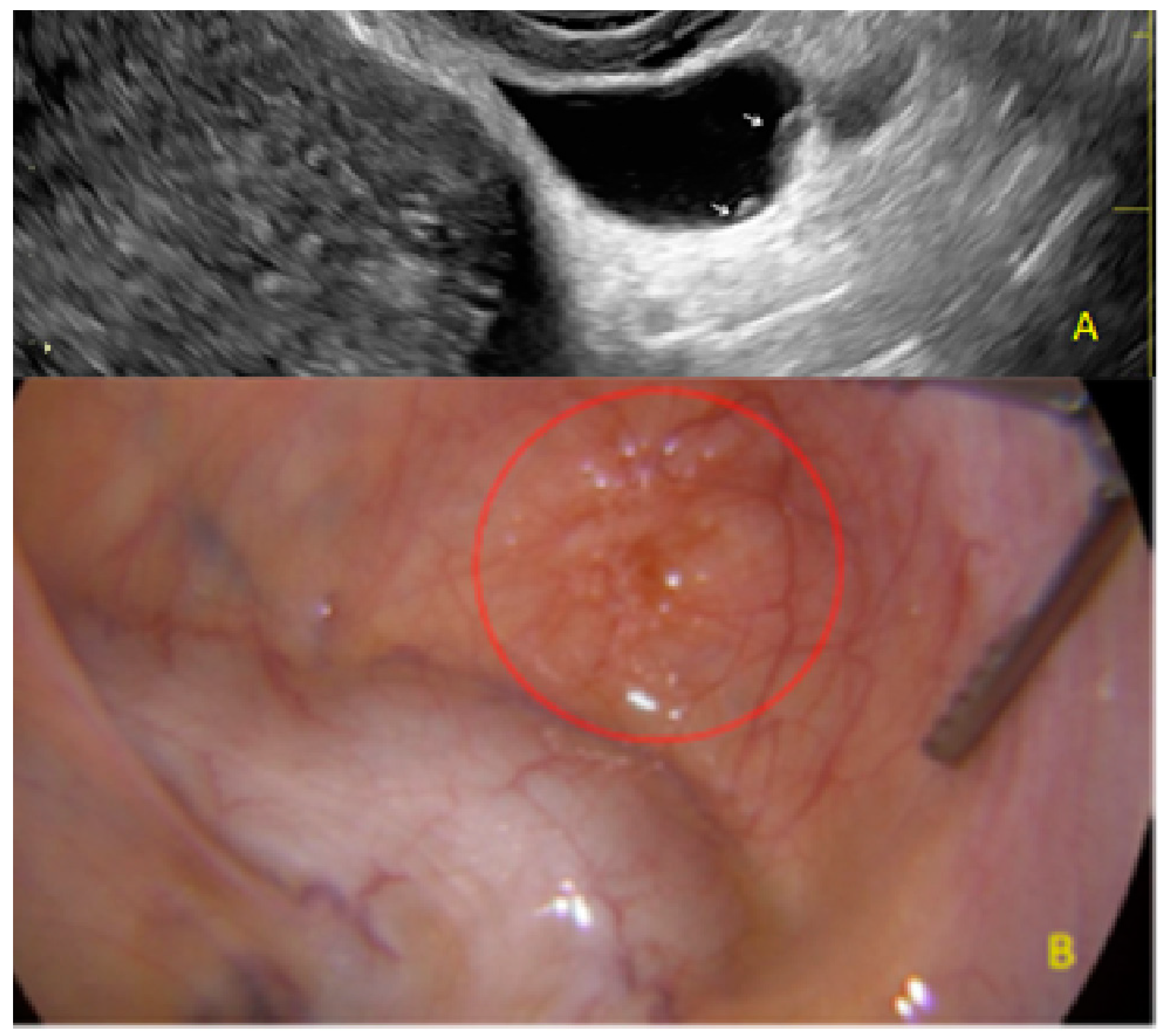 Diagnostics 13 01876 g008 Diagnostics 13 01876 g008