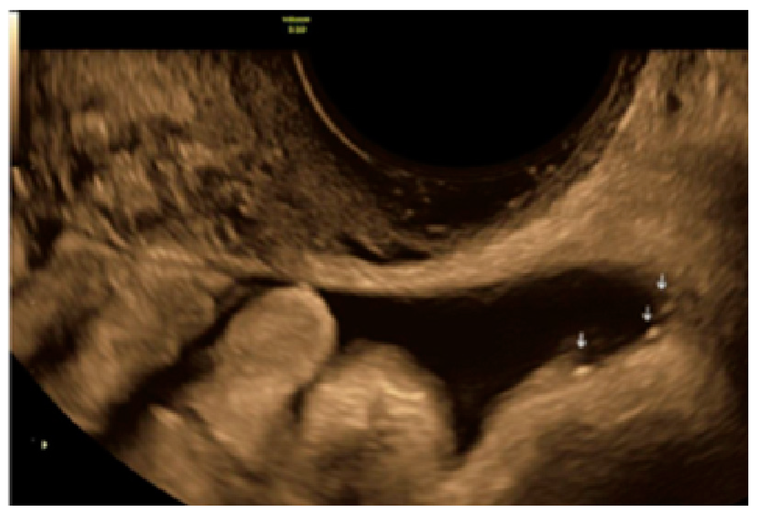 Diagnostics 13 01876 g010 Diagnostics 13 01876 g010