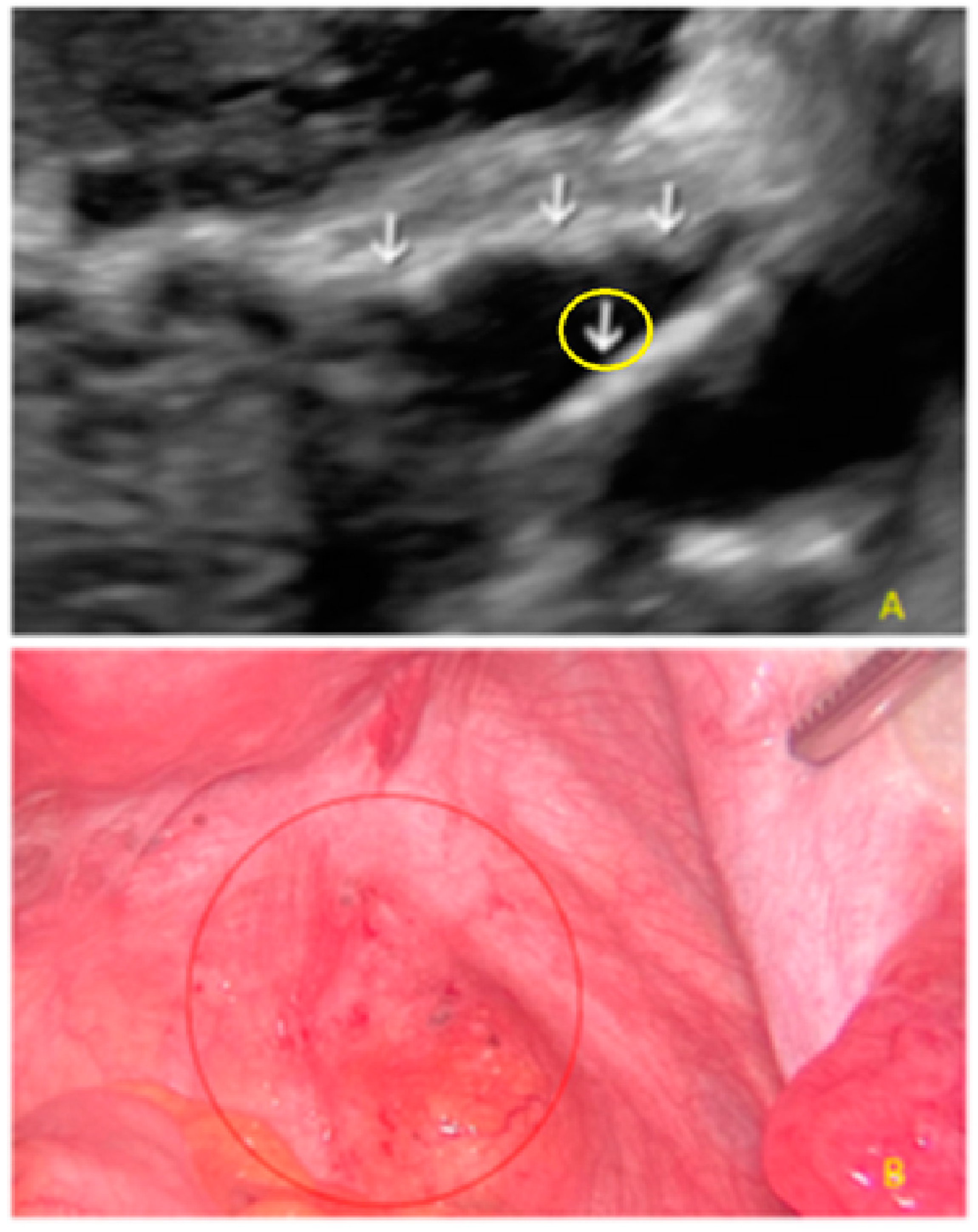 Diagnostics 13 01876 g011 Diagnostics 13 01876 g011
