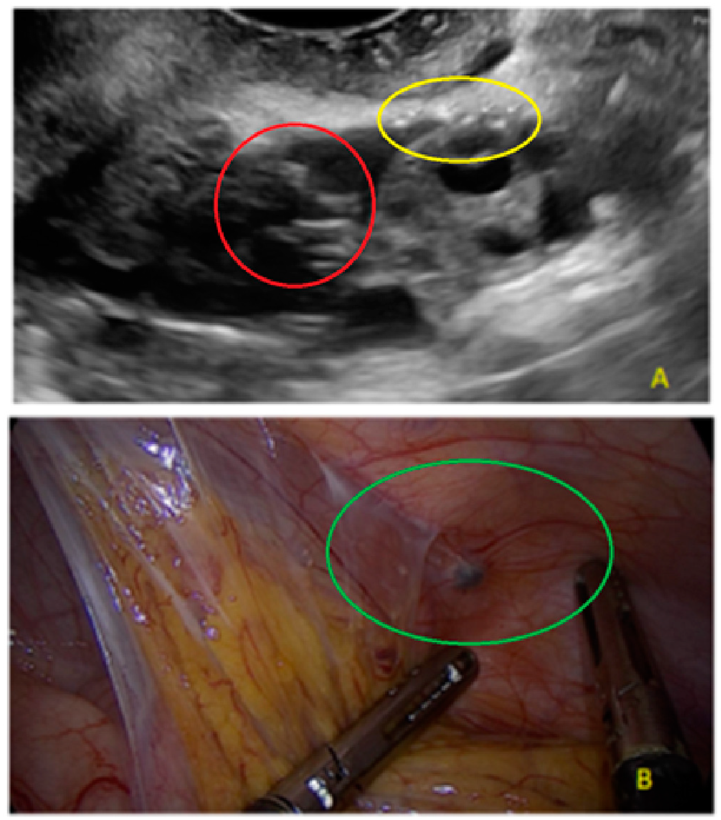 Diagnostics 13 01876 g012 Diagnostics 13 01876 g012