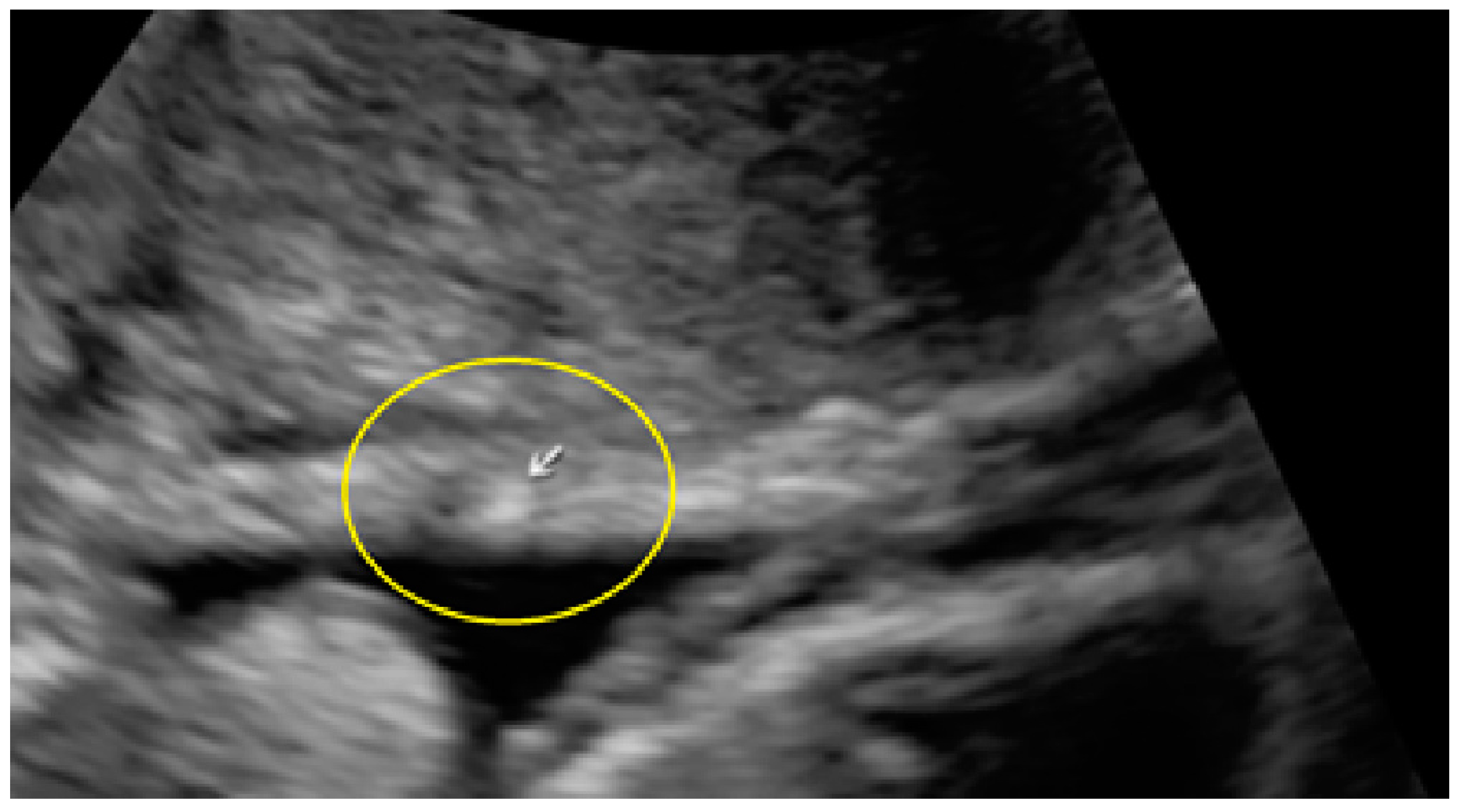 Diagnostics 13 01876 g013 Diagnostics 13 01876 g013