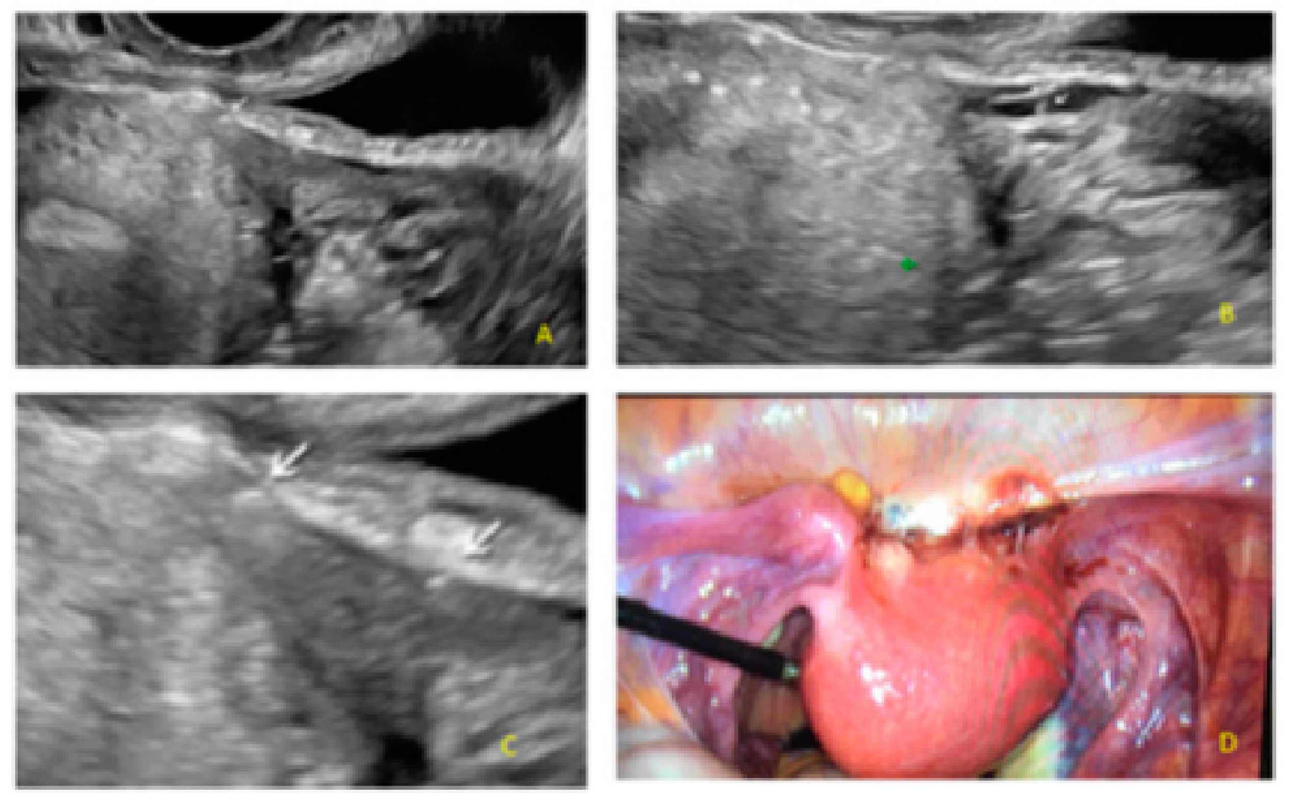 Diagnostics 13 01876 g014 Diagnostics 13 01876 g014