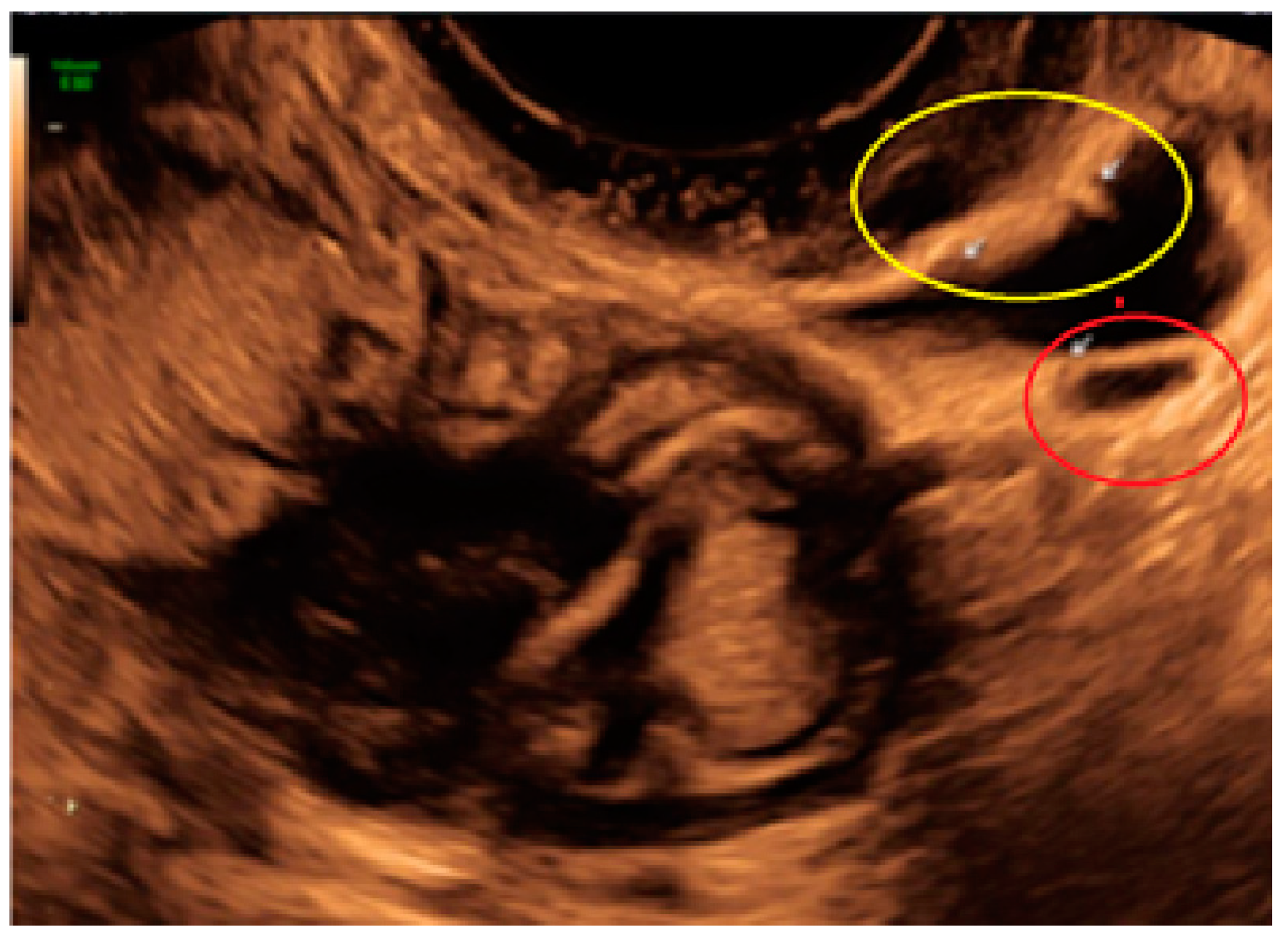 Diagnostics 13 01876 g015 Diagnostics 13 01876 g015