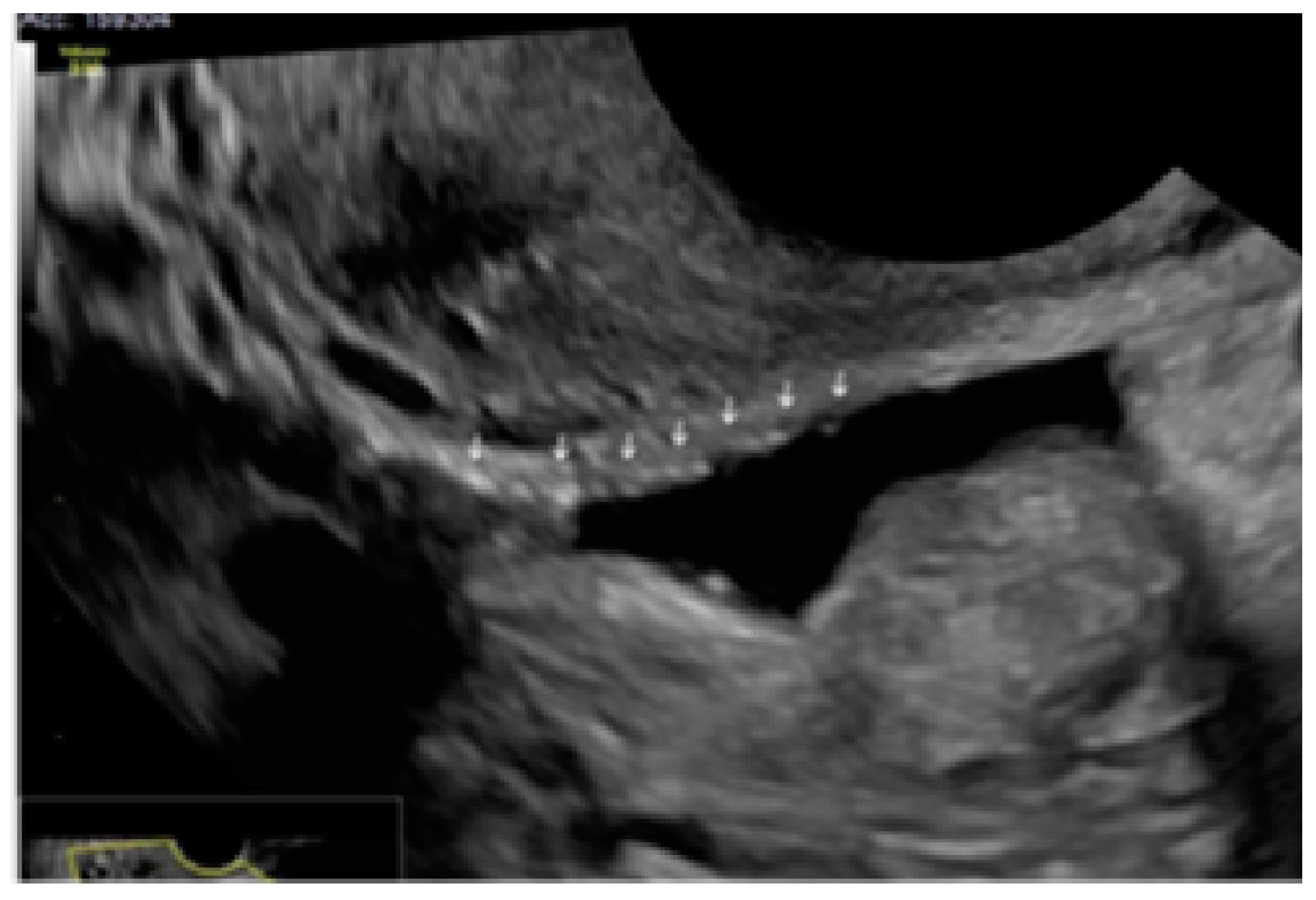 Diagnostics 13 01876 g016 Diagnostics 13 01876 g016