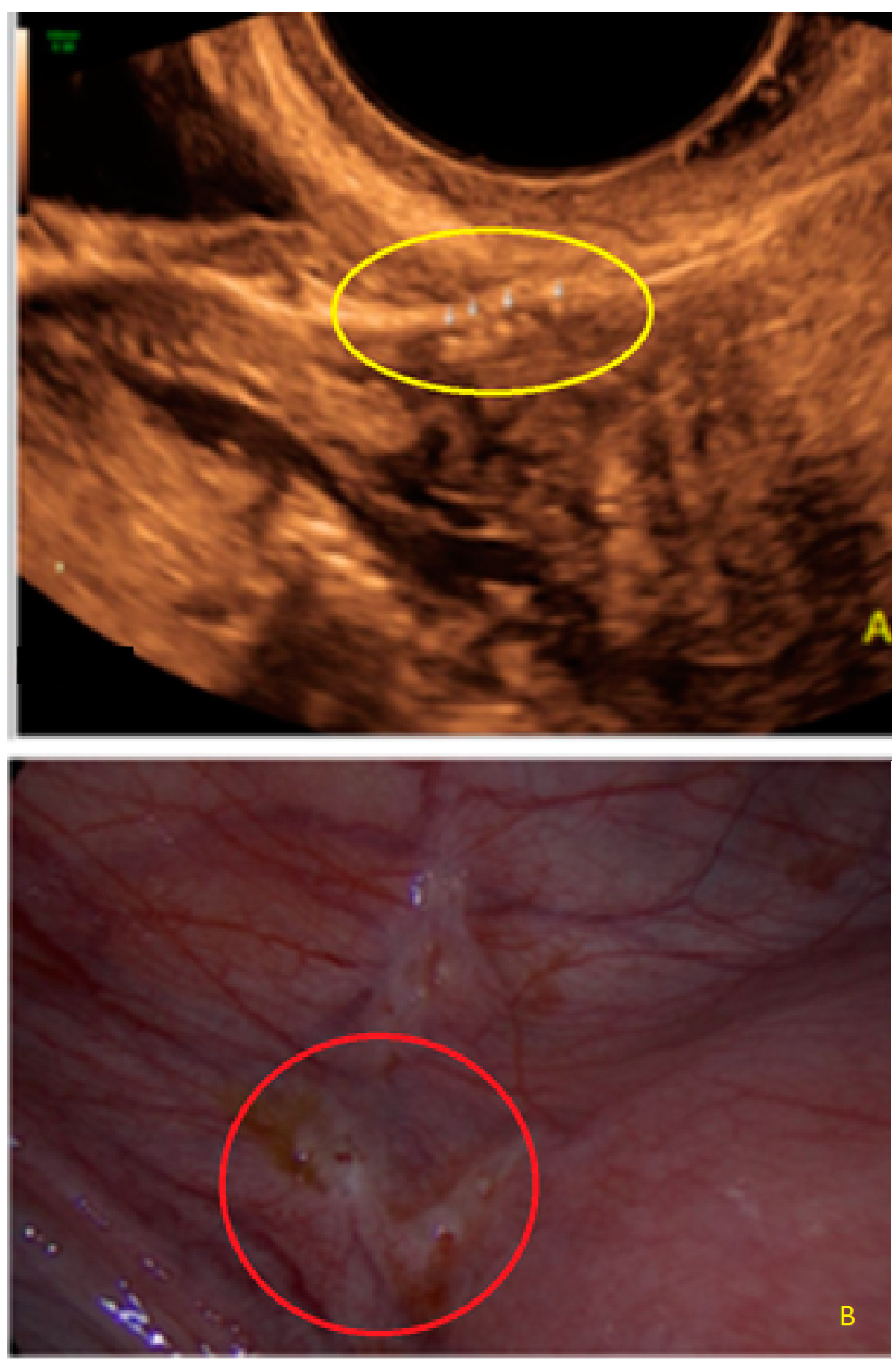 Diagnostics 13 01876 g017 Diagnostics 13 01876 g017