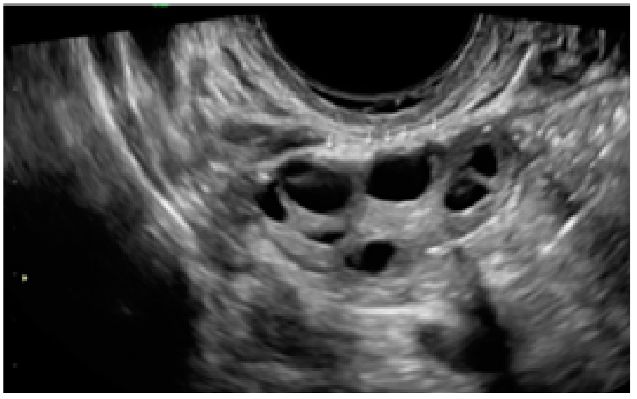 Diagnostics 13 01876 g019 Diagnostics 13 01876 g019