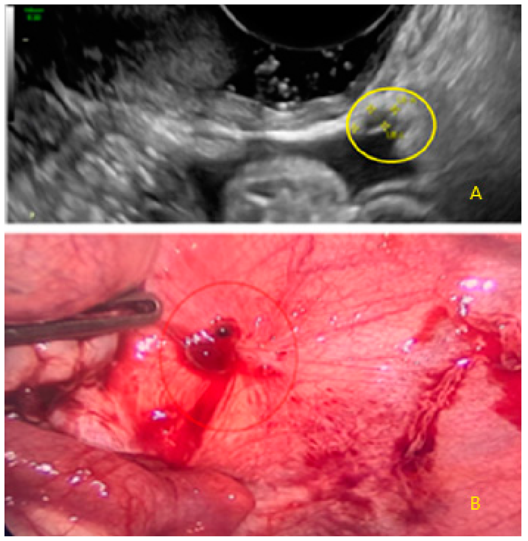 Diagnostics 13 01876 g022 Diagnostics 13 01876 g022