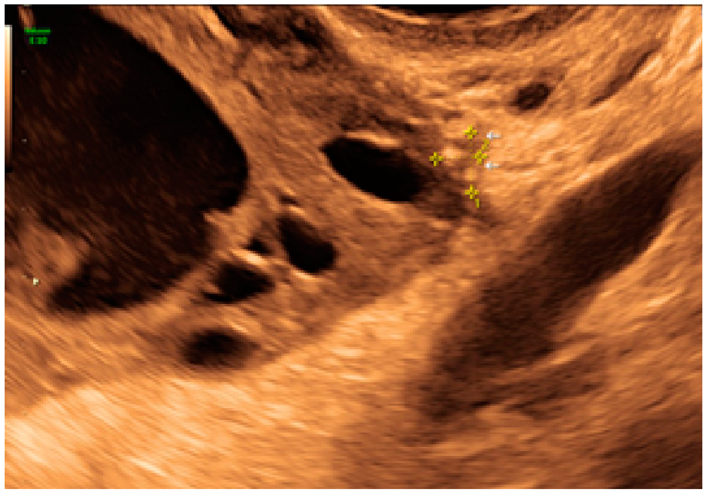 Diagnostics 13 01876 g027 Diagnostics 13 01876 g027