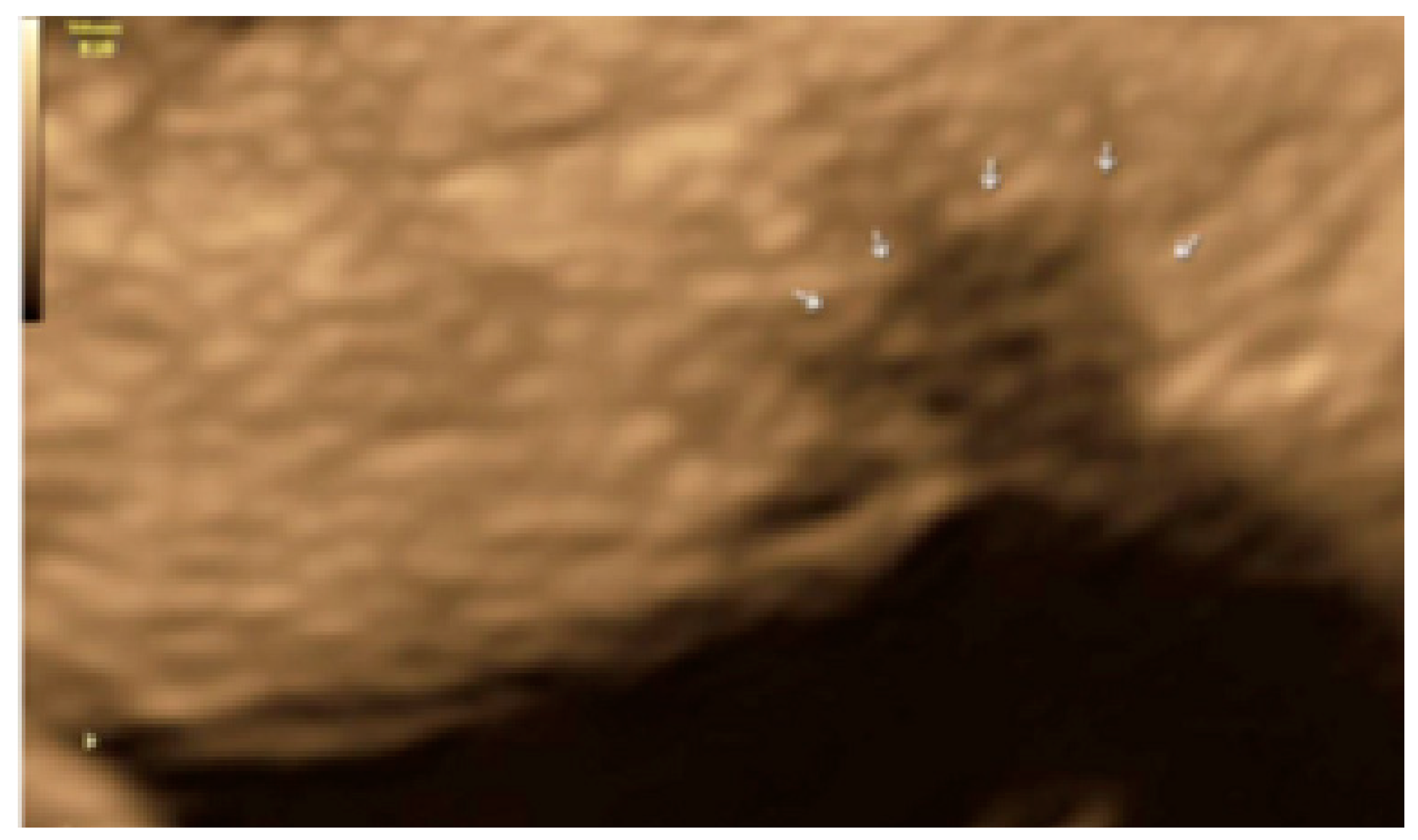 Diagnostics 13 01876 g028 Diagnostics 13 01876 g028