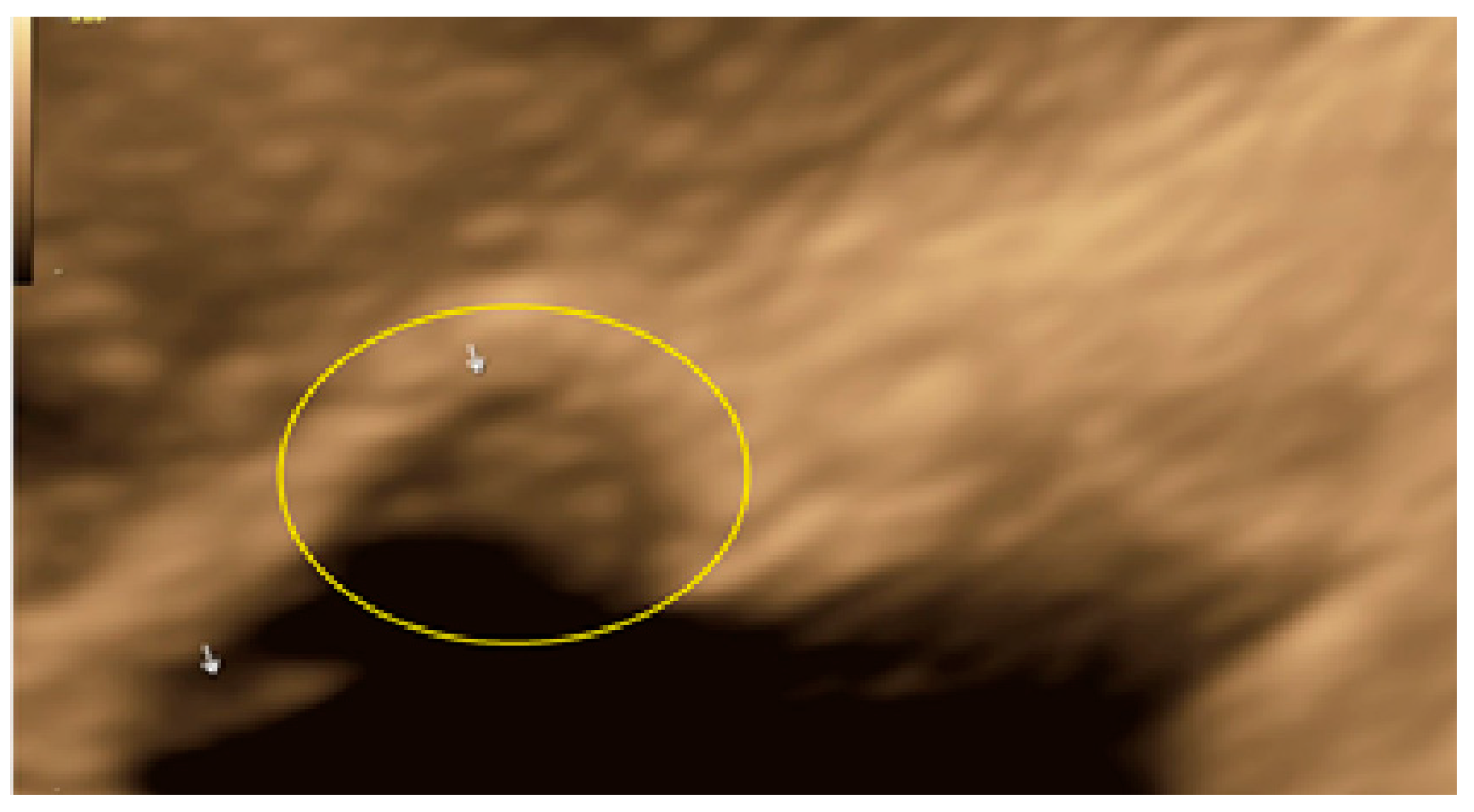 Diagnostics 13 01876 g030 Diagnostics 13 01876 g030