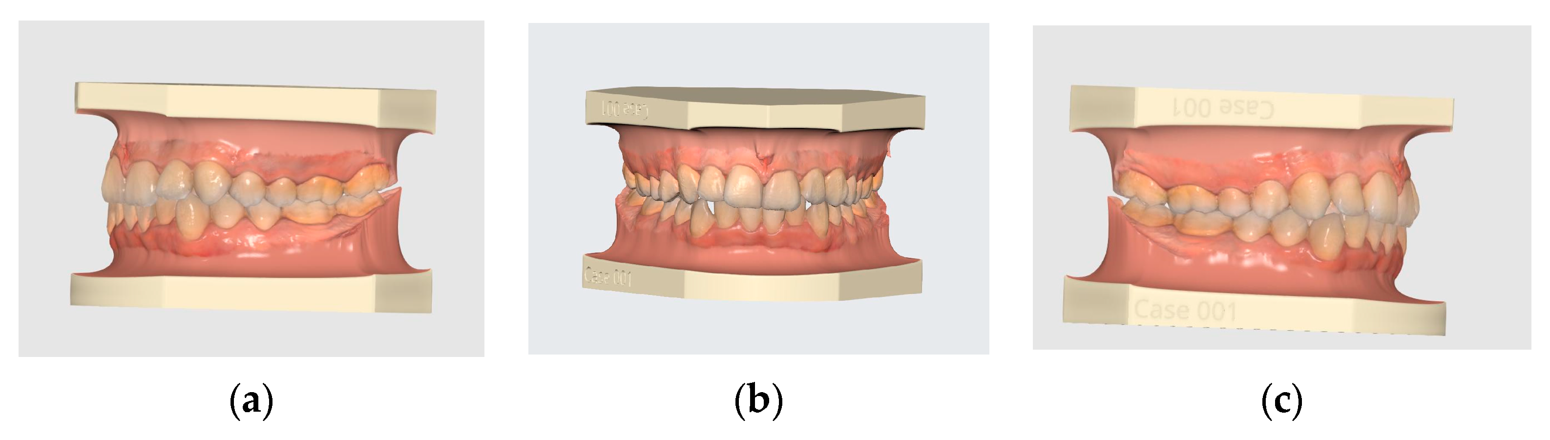 Diagnostics 13 01900 g001