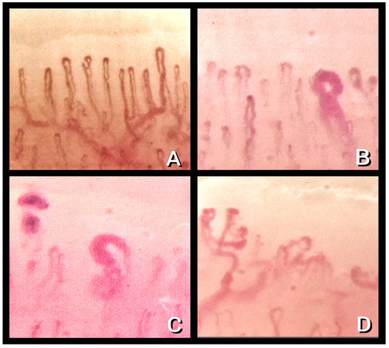 Nailfold capillary patterns correlate with age, gender, lifestyle habits,  and fingertip temperature | PLOS ONE