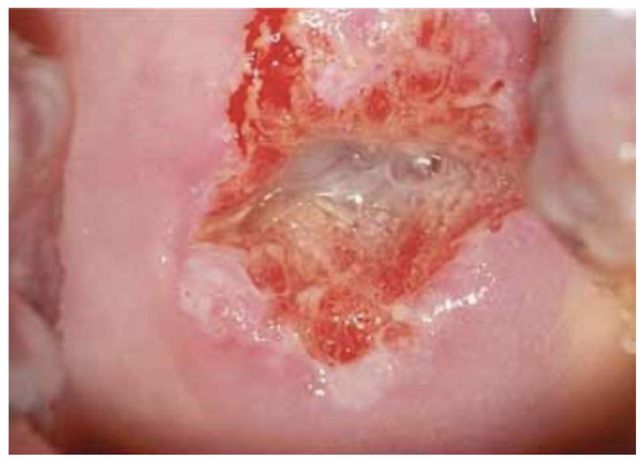 Diagnostics 13 01906 g001