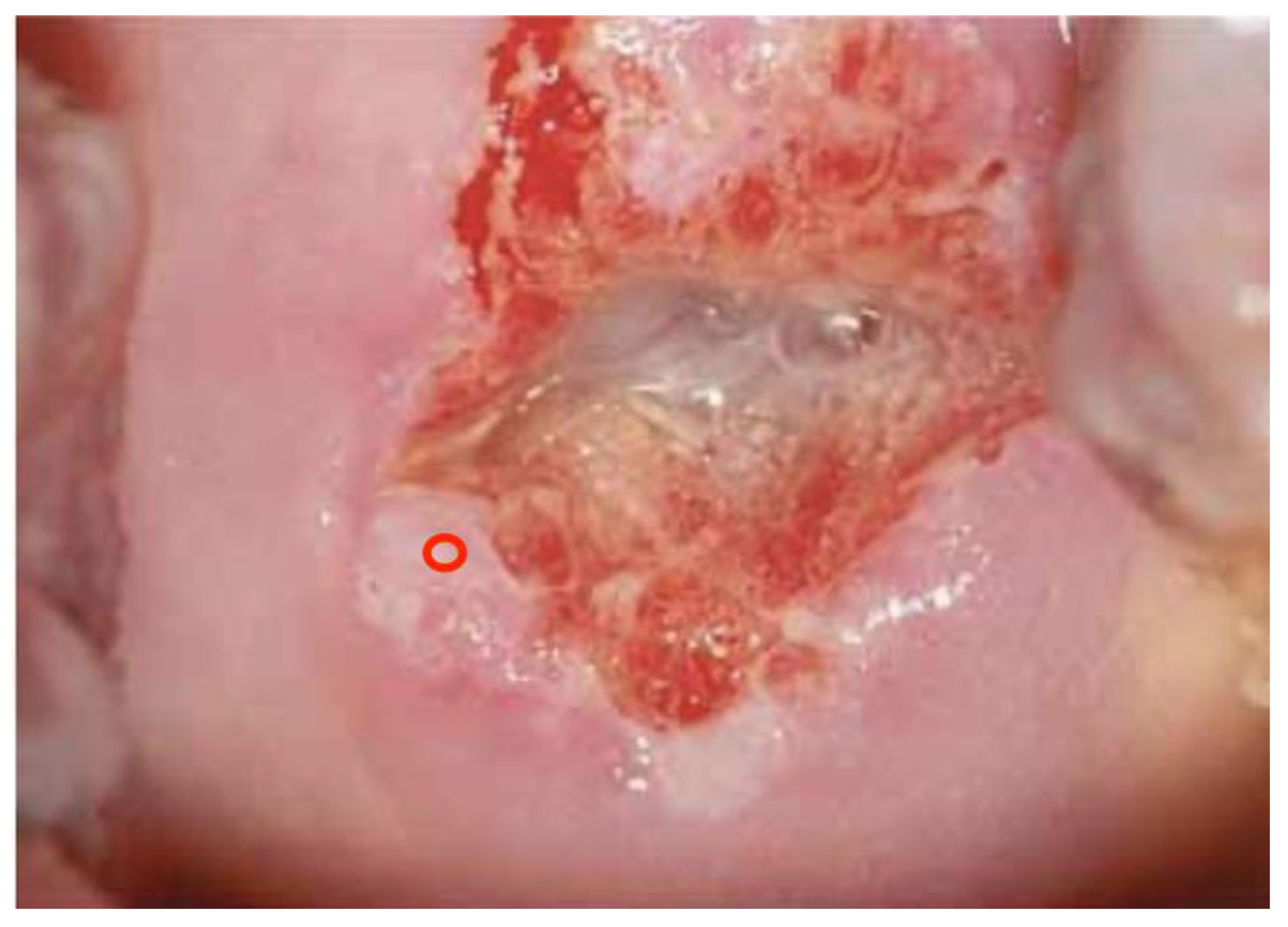 Diagnostics 13 01906 g004