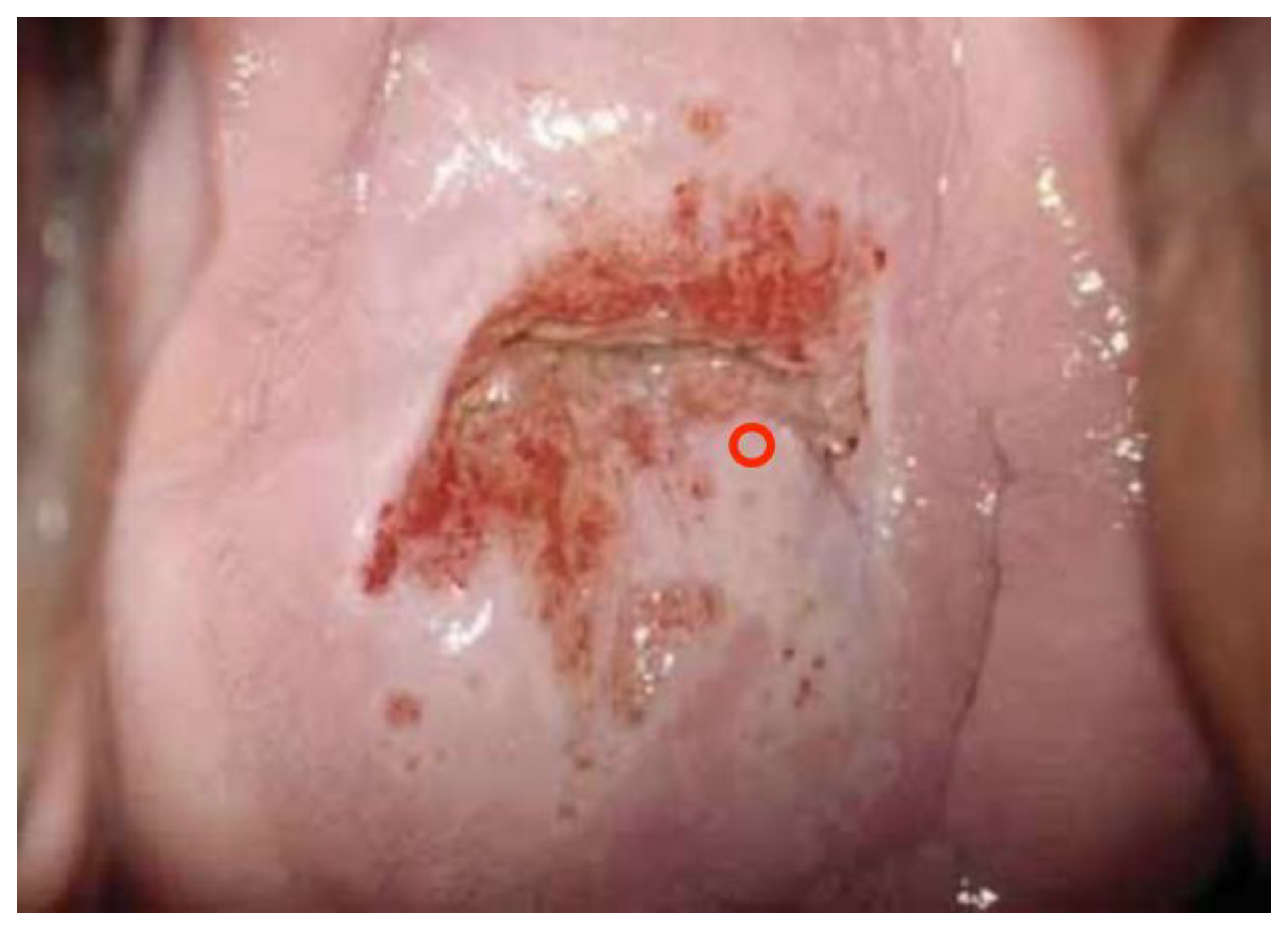 Diagnostics 13 01906 g006