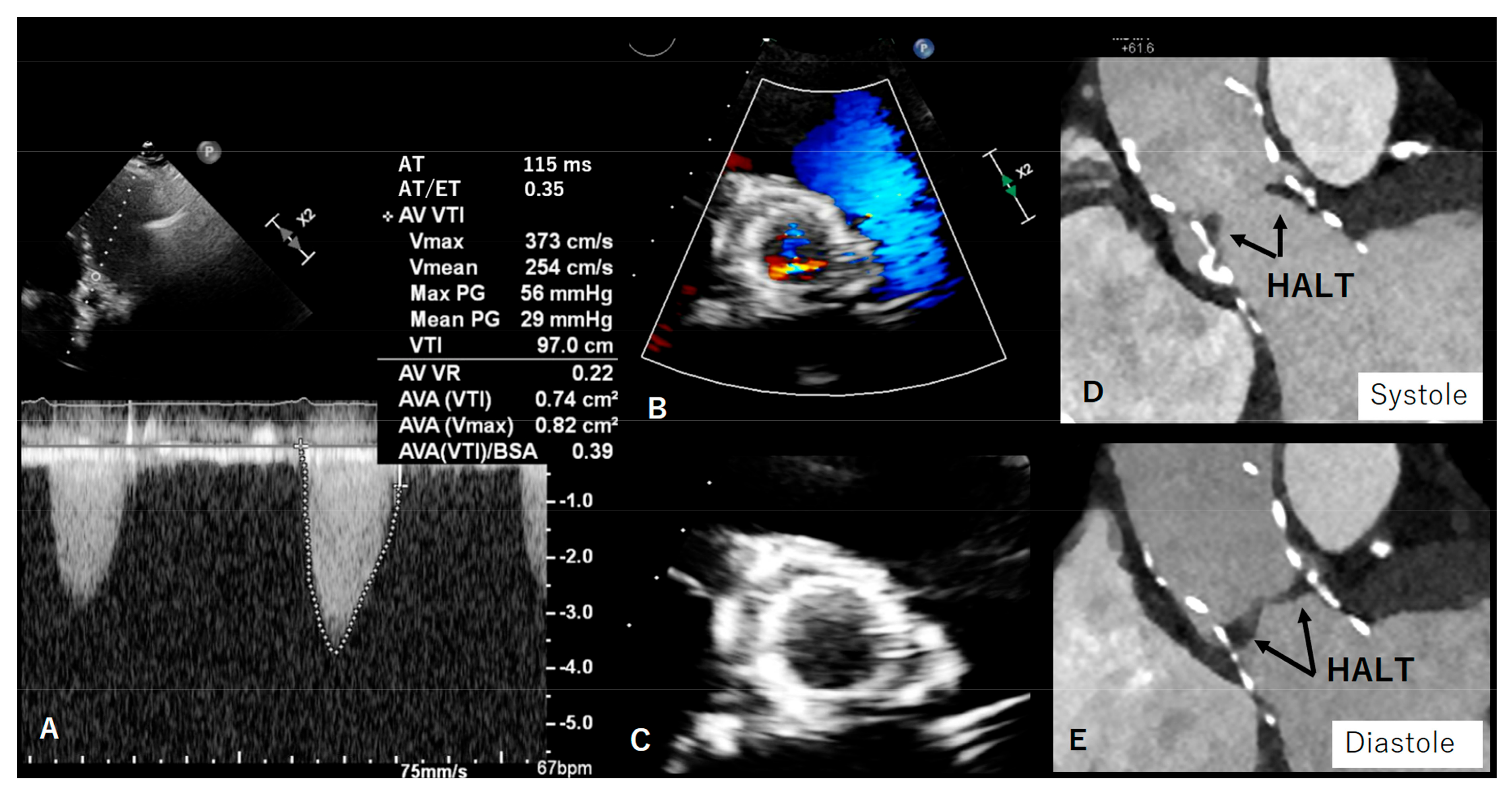 Diagnostics 13 01908 g005 Diagnostics 13 01908 g005