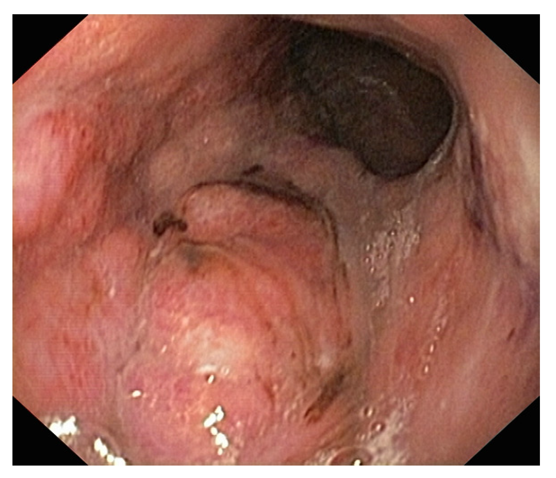 Diagnostics 13 01909 g003