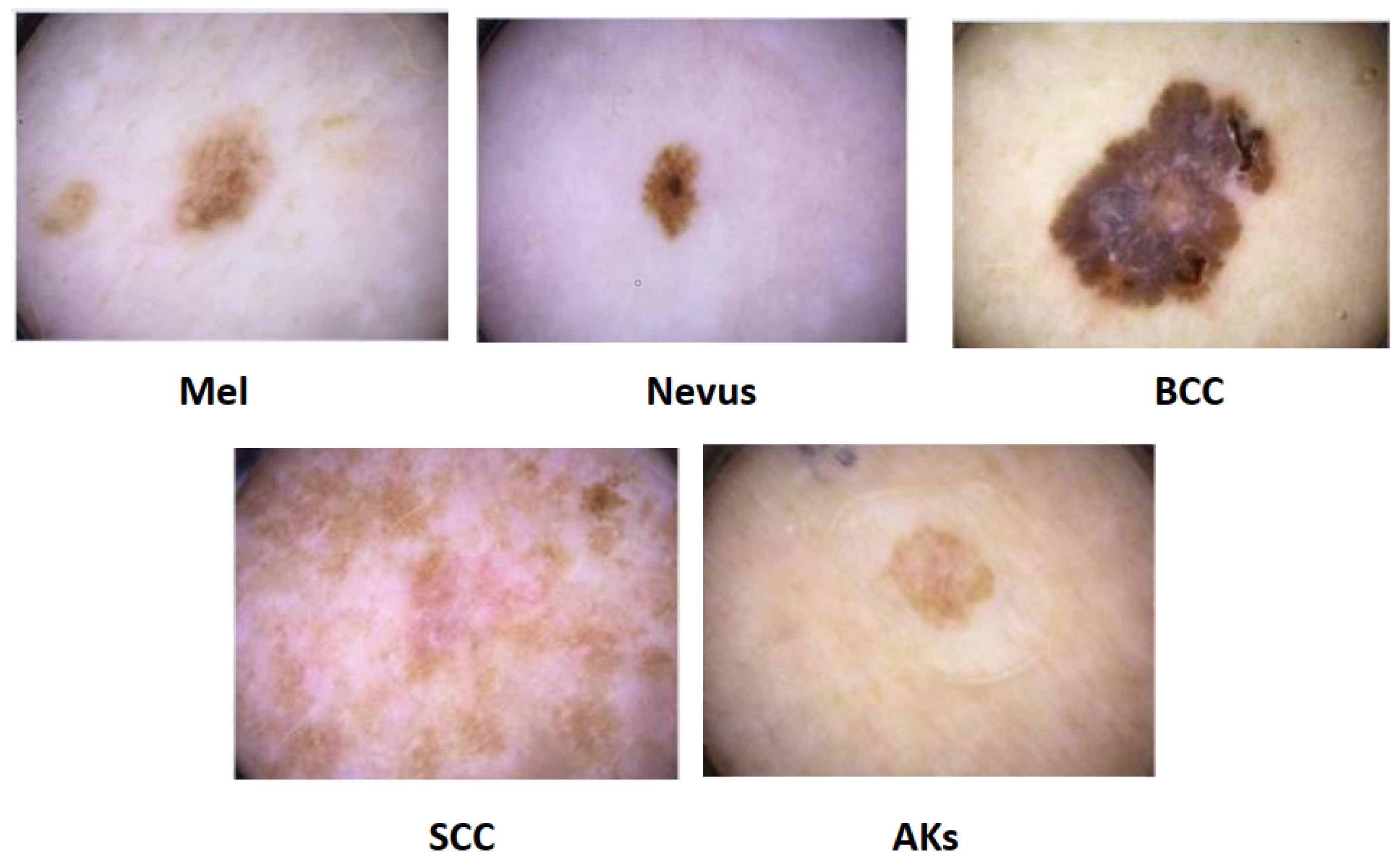 Diagnostics 13 01911 g015 Diagnostics 13 01911 g015