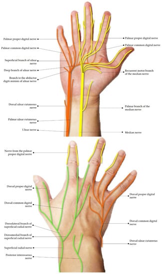 Nerve Damage In The Hand - Golden State Orthopedics & Spine