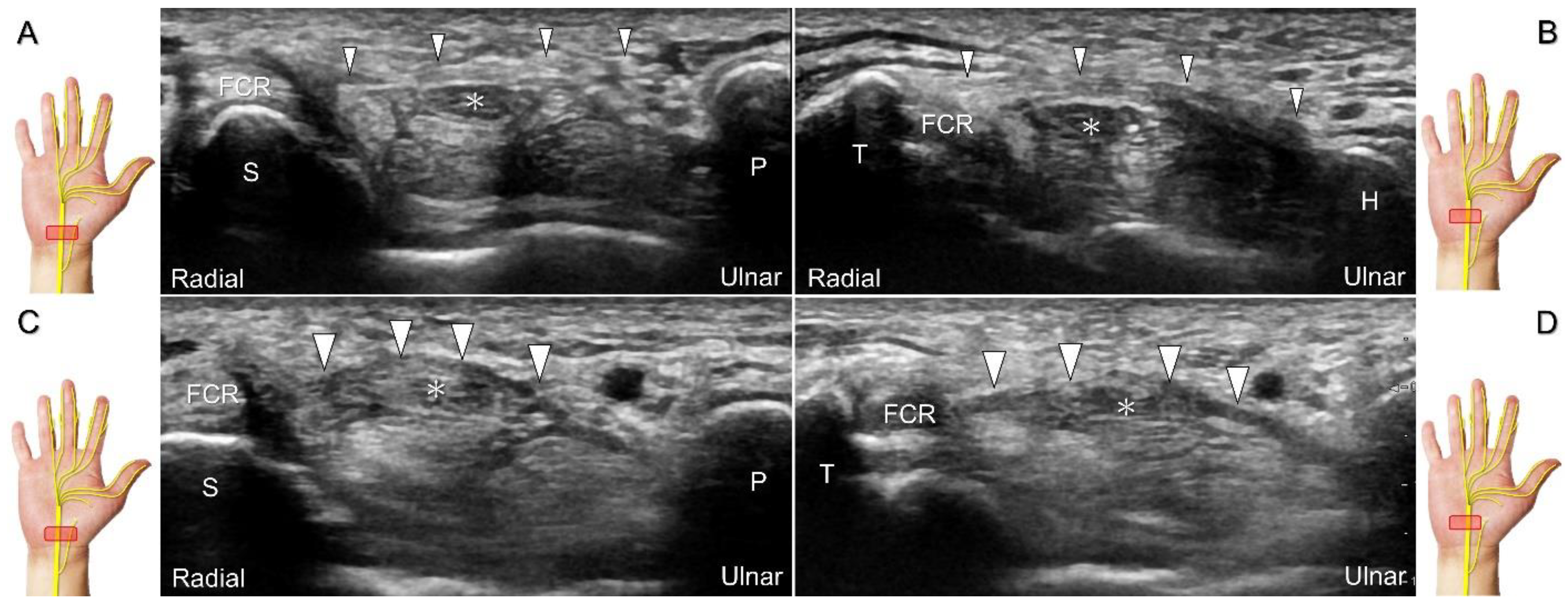 Diagnostics 13 01928 g002
