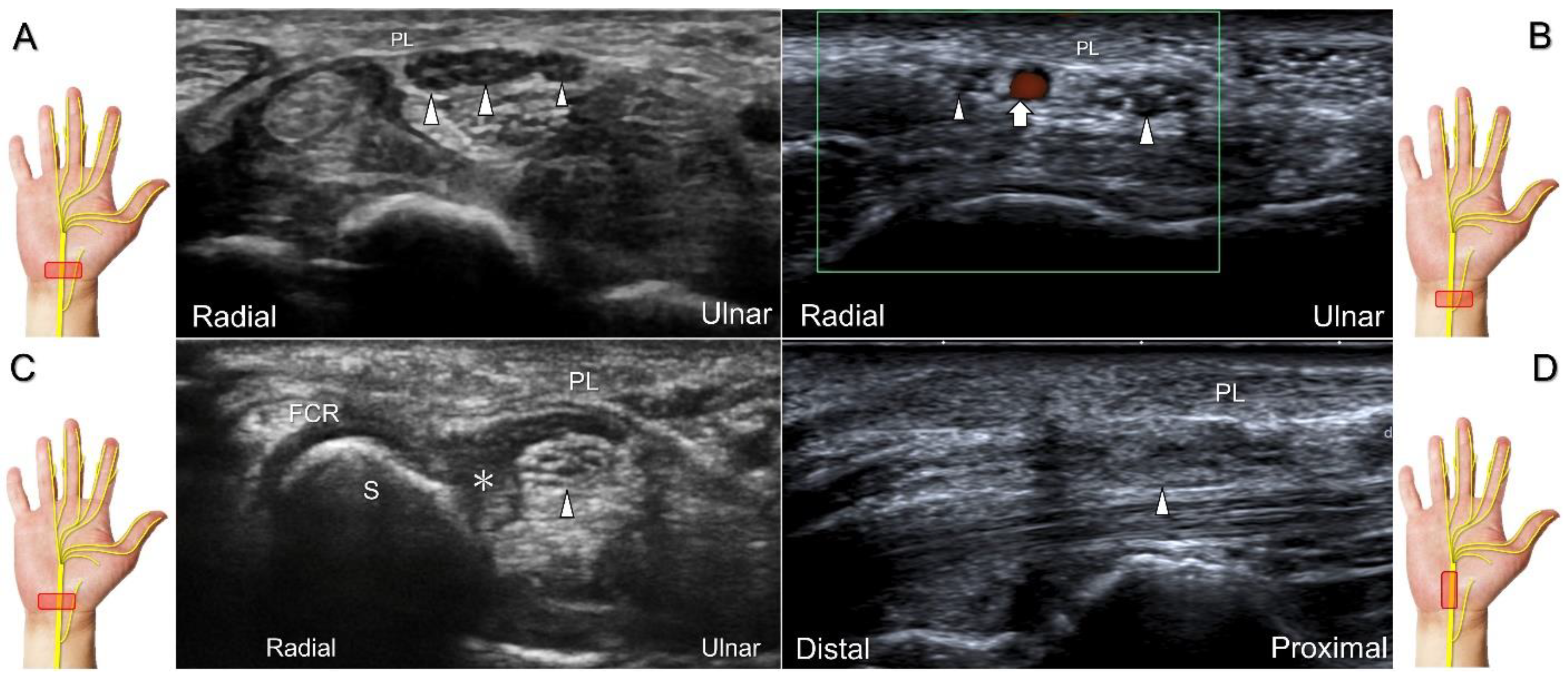 Diagnostics 13 01928 g004