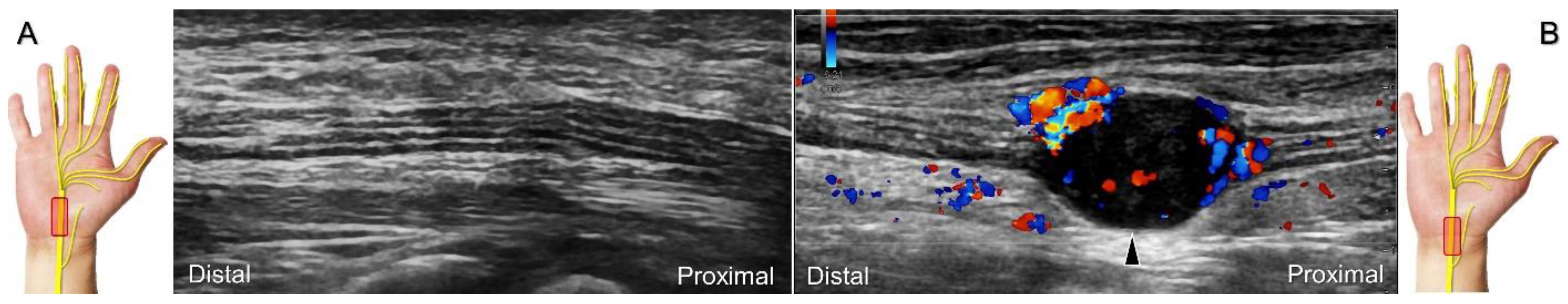 Diagnostics 13 01928 g005