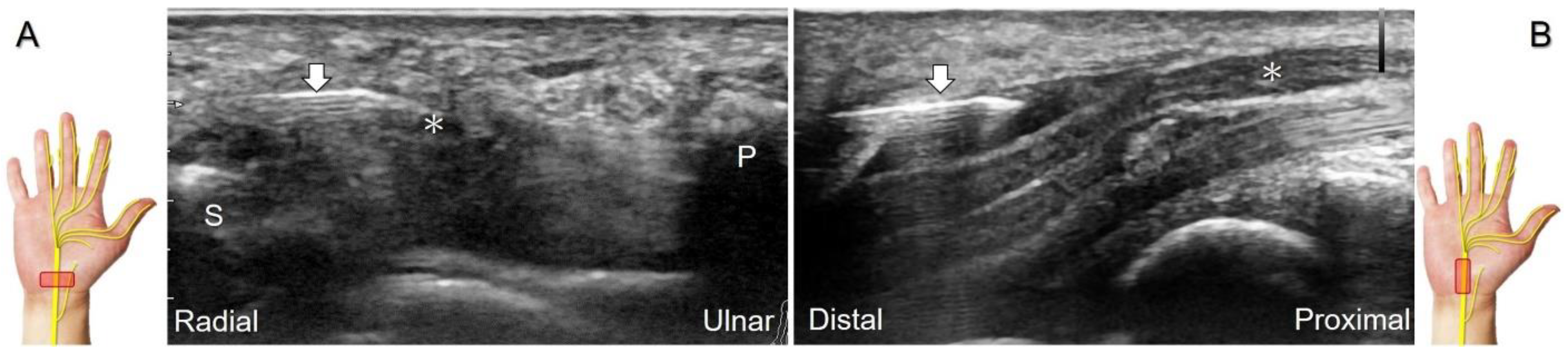 Diagnostics 13 01928 g006