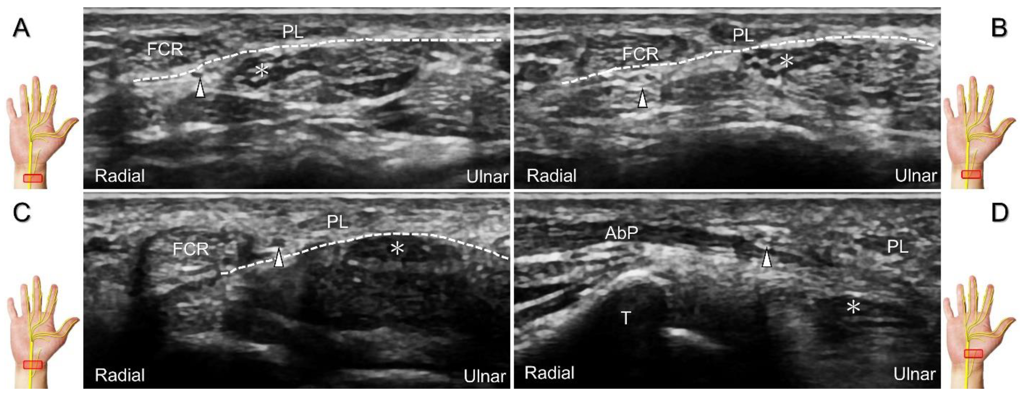 Diagnostics 13 01928 g007