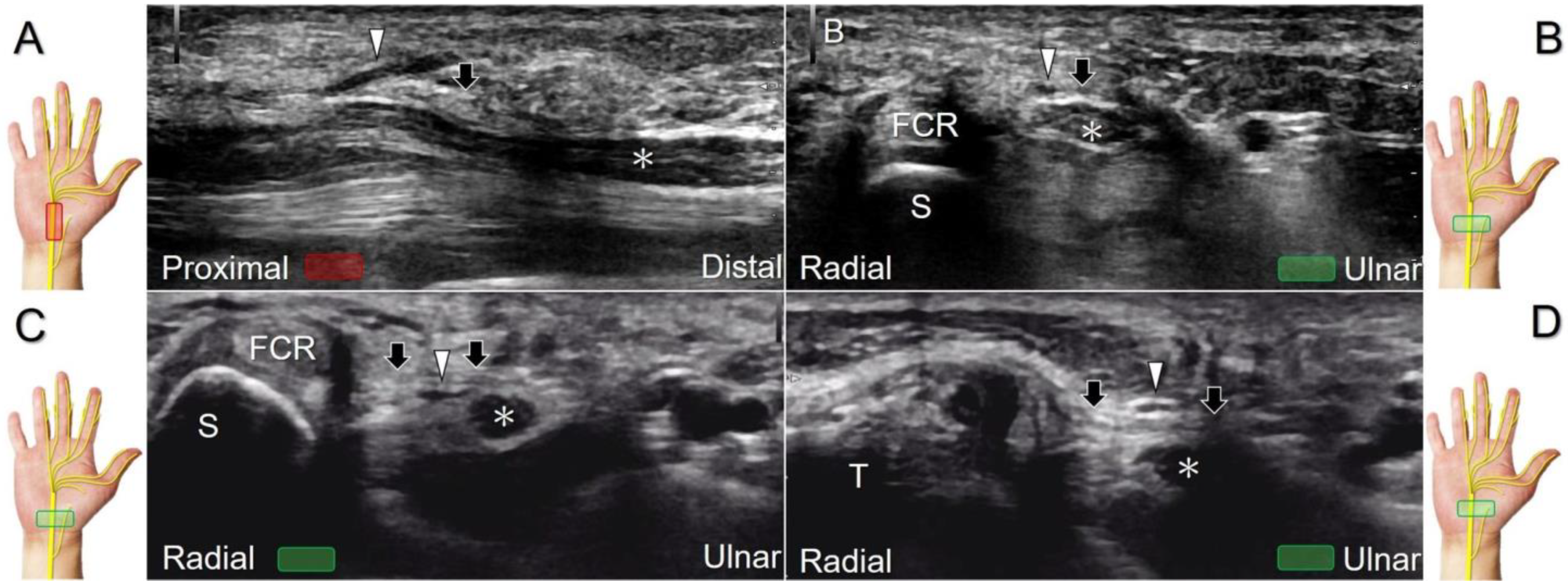 Diagnostics 13 01928 g011