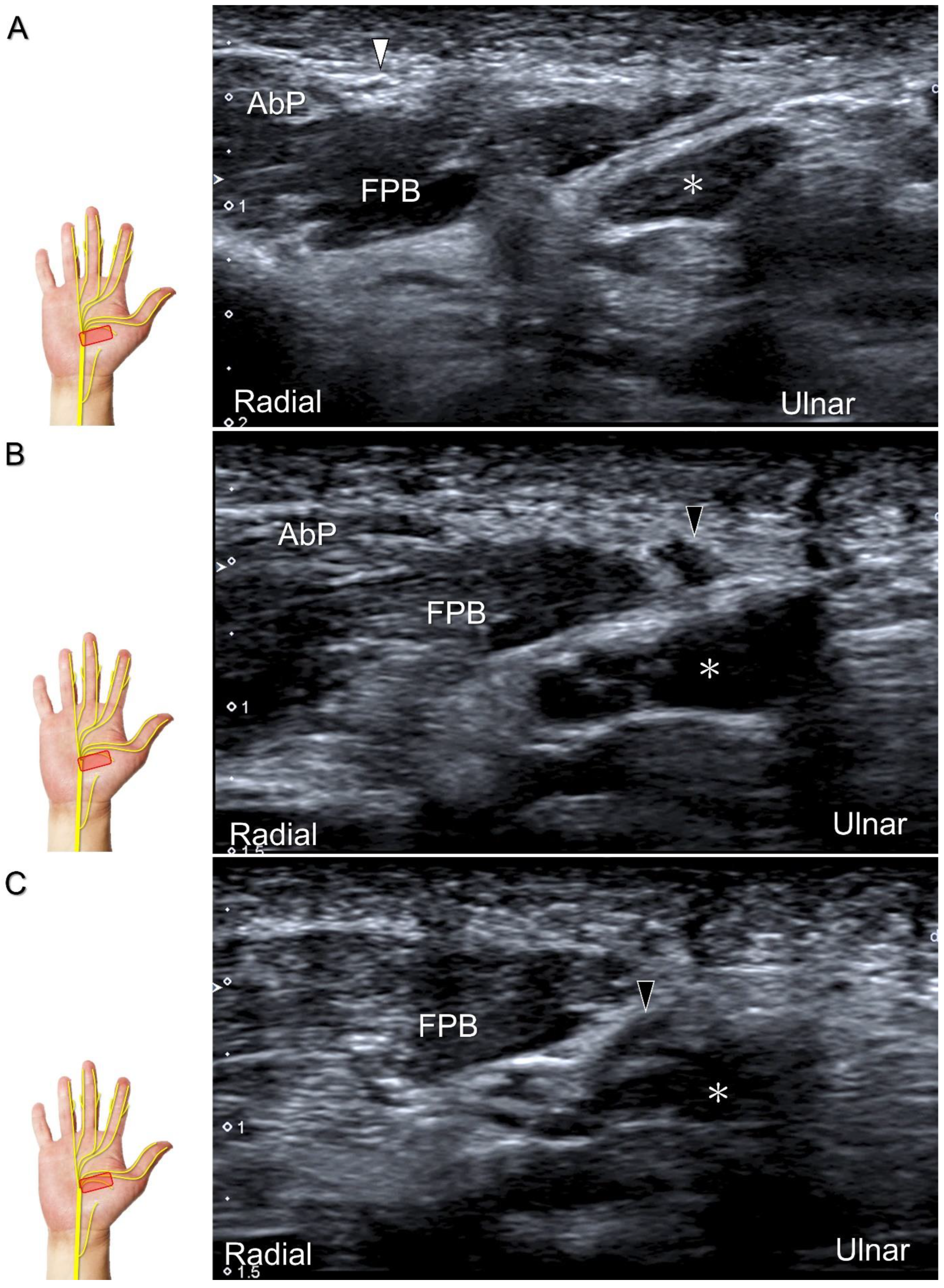 Diagnostics 13 01928 g012