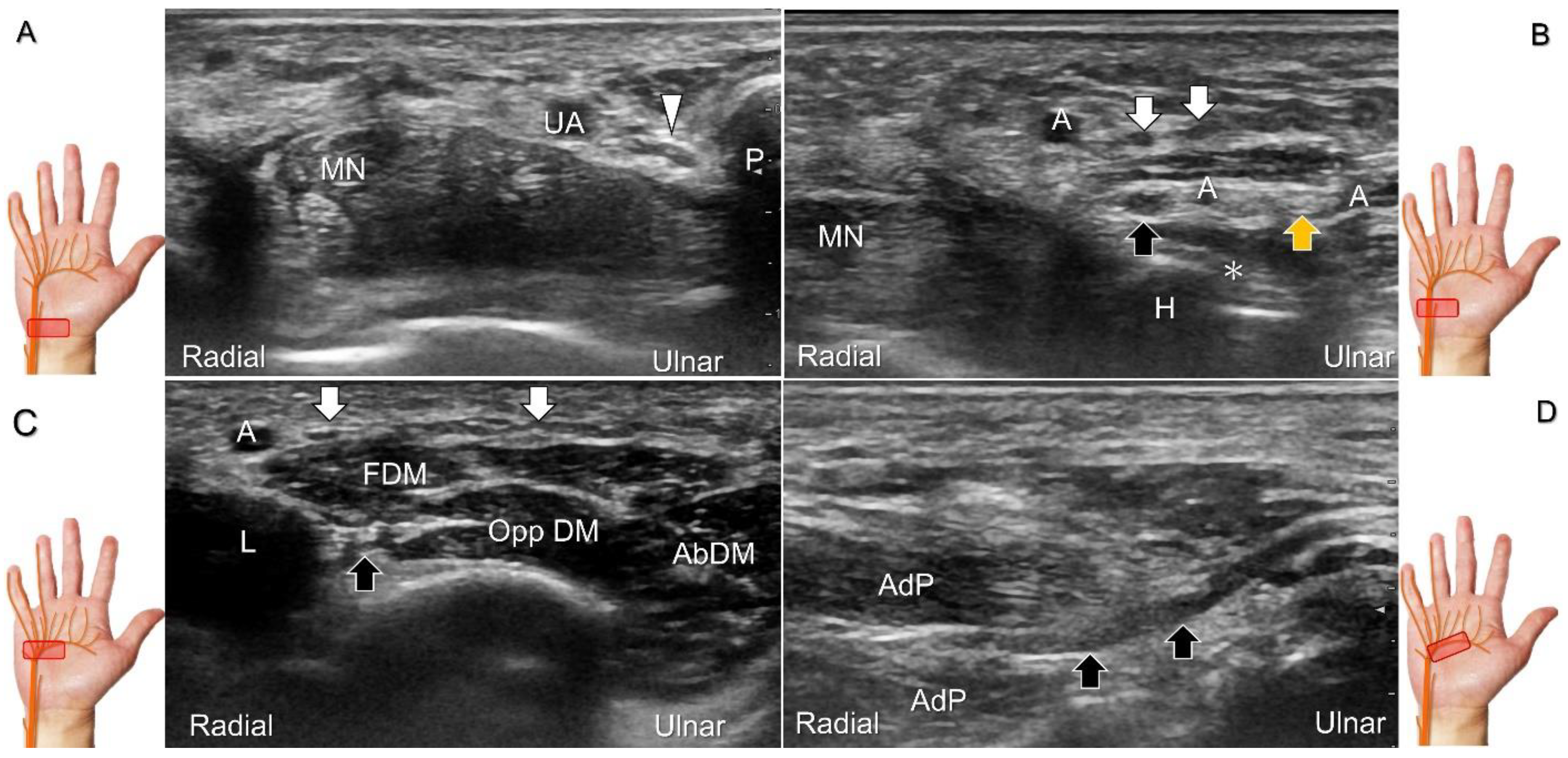 Diagnostics 13 01928 g013