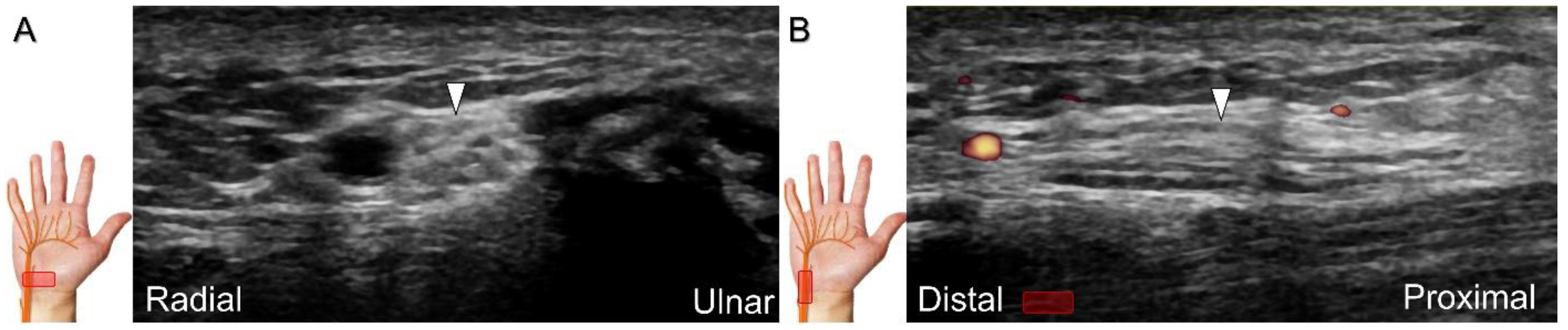 Diagnostics 13 01928 g014