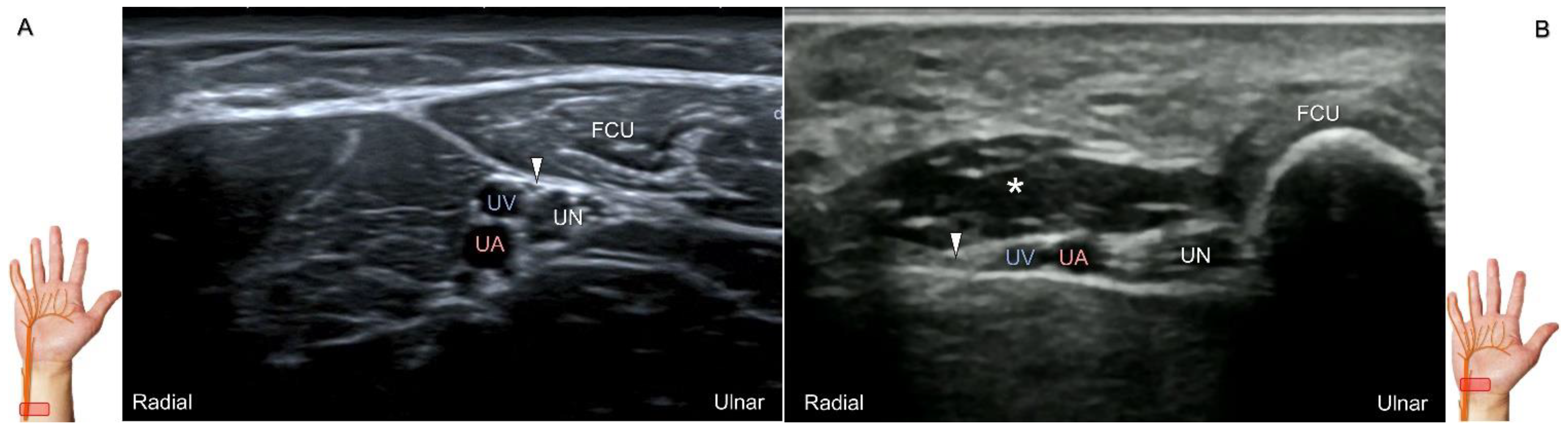 Diagnostics 13 01928 g018
