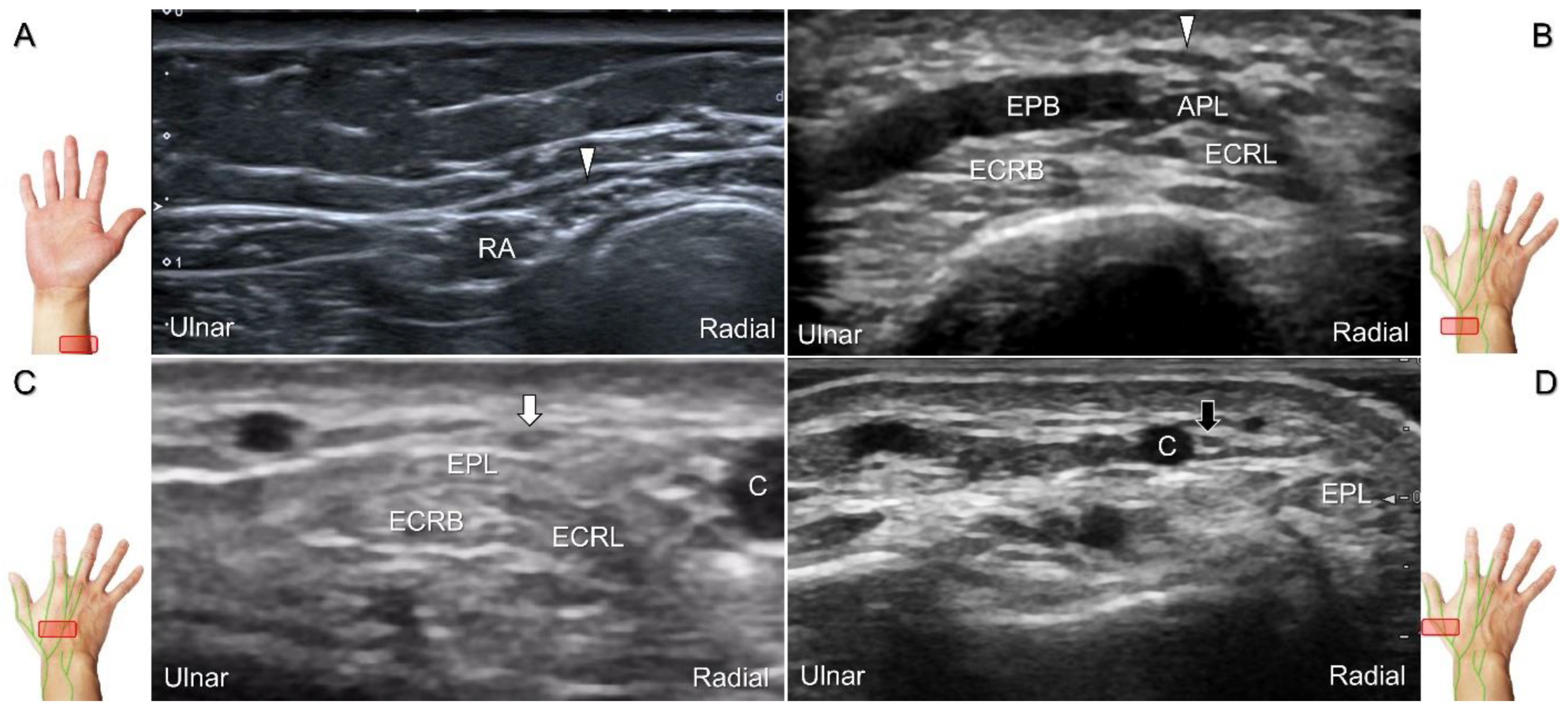 Diagnostics 13 01928 g021