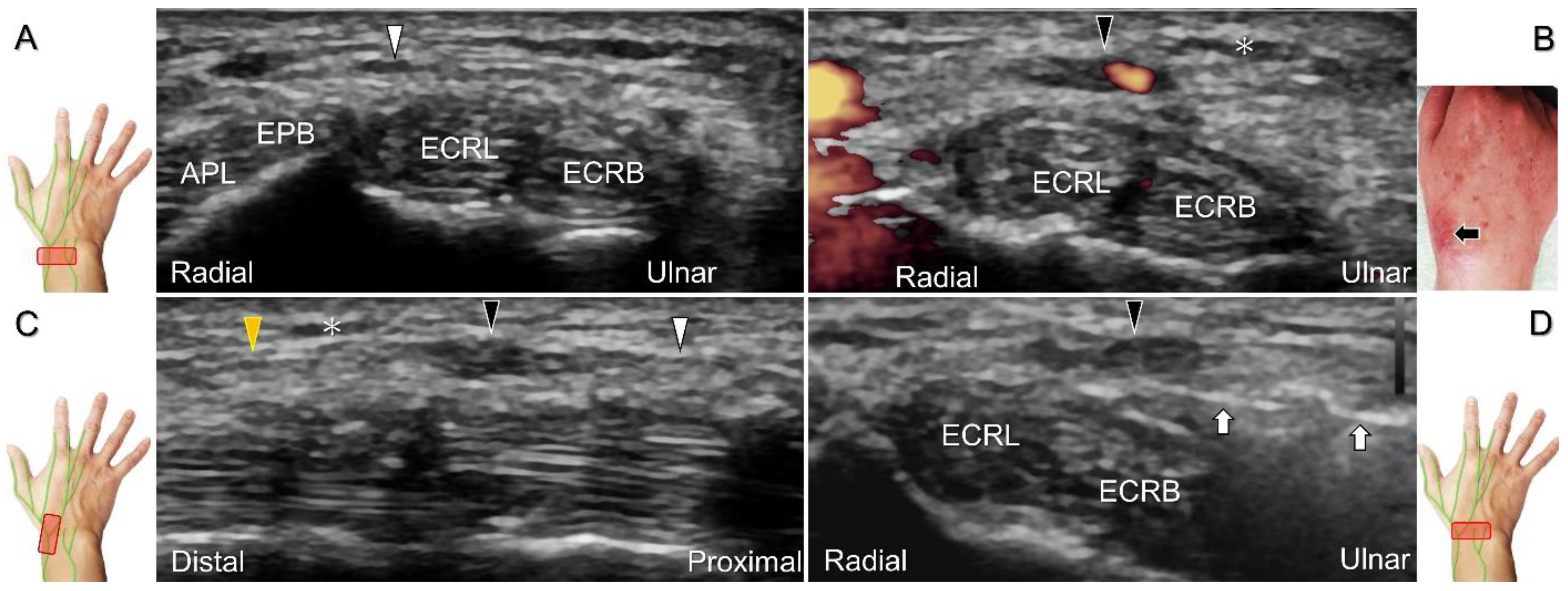 Diagnostics 13 01928 g024