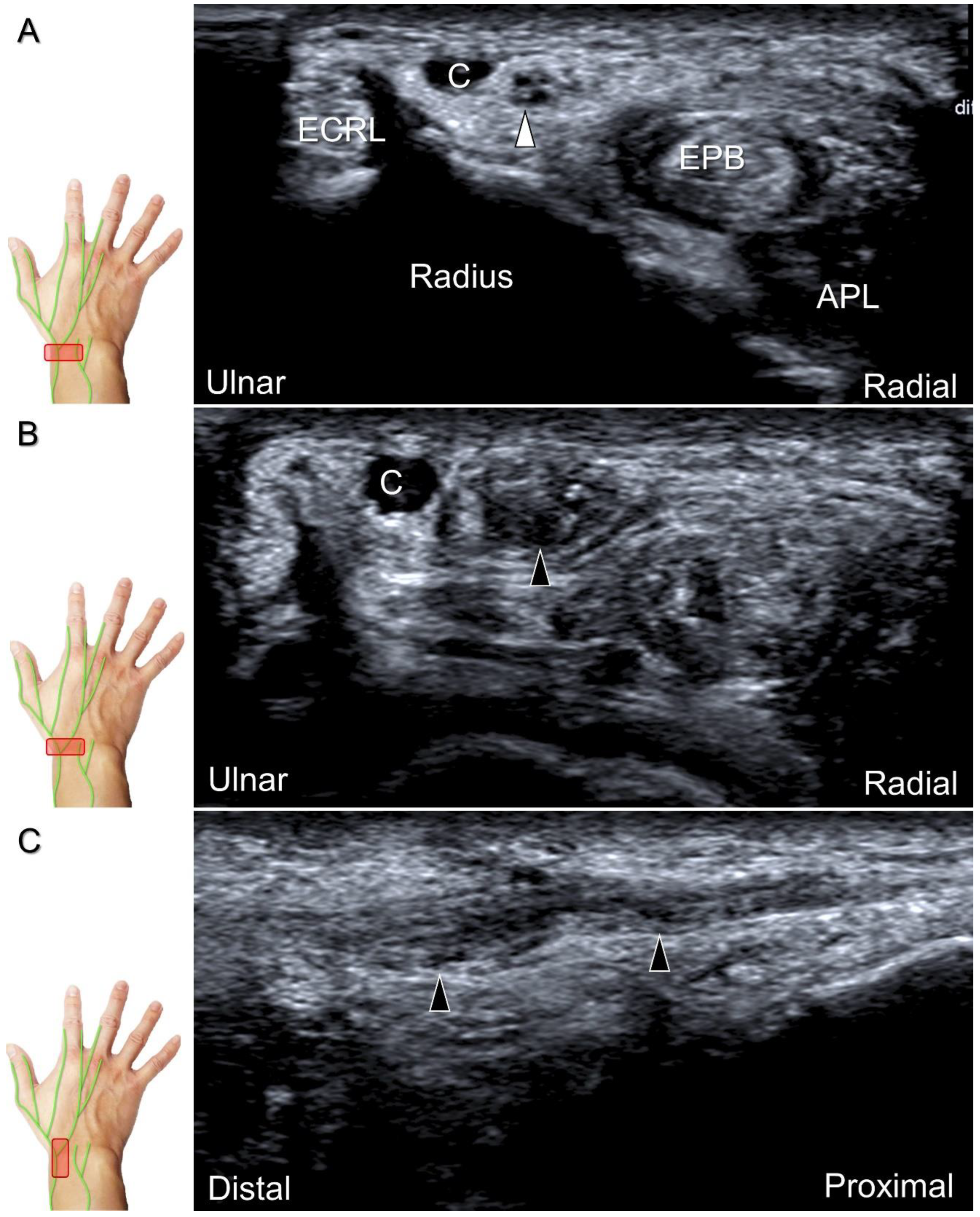 Diagnostics 13 01928 g025