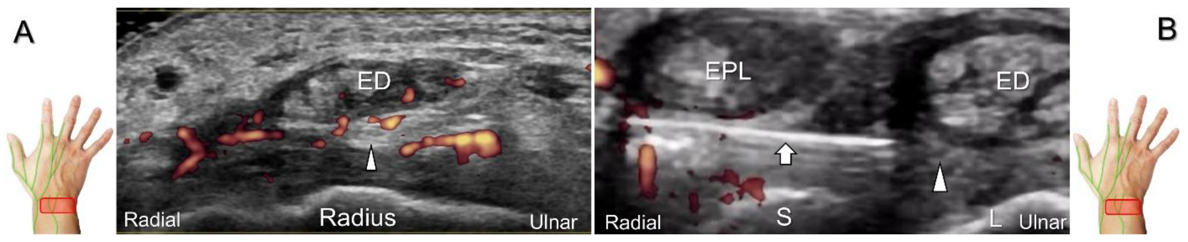 Diagnostics 13 01928 g027